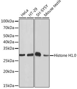 Western blot - Histone H1.0 Rabbit mAb (A4342)