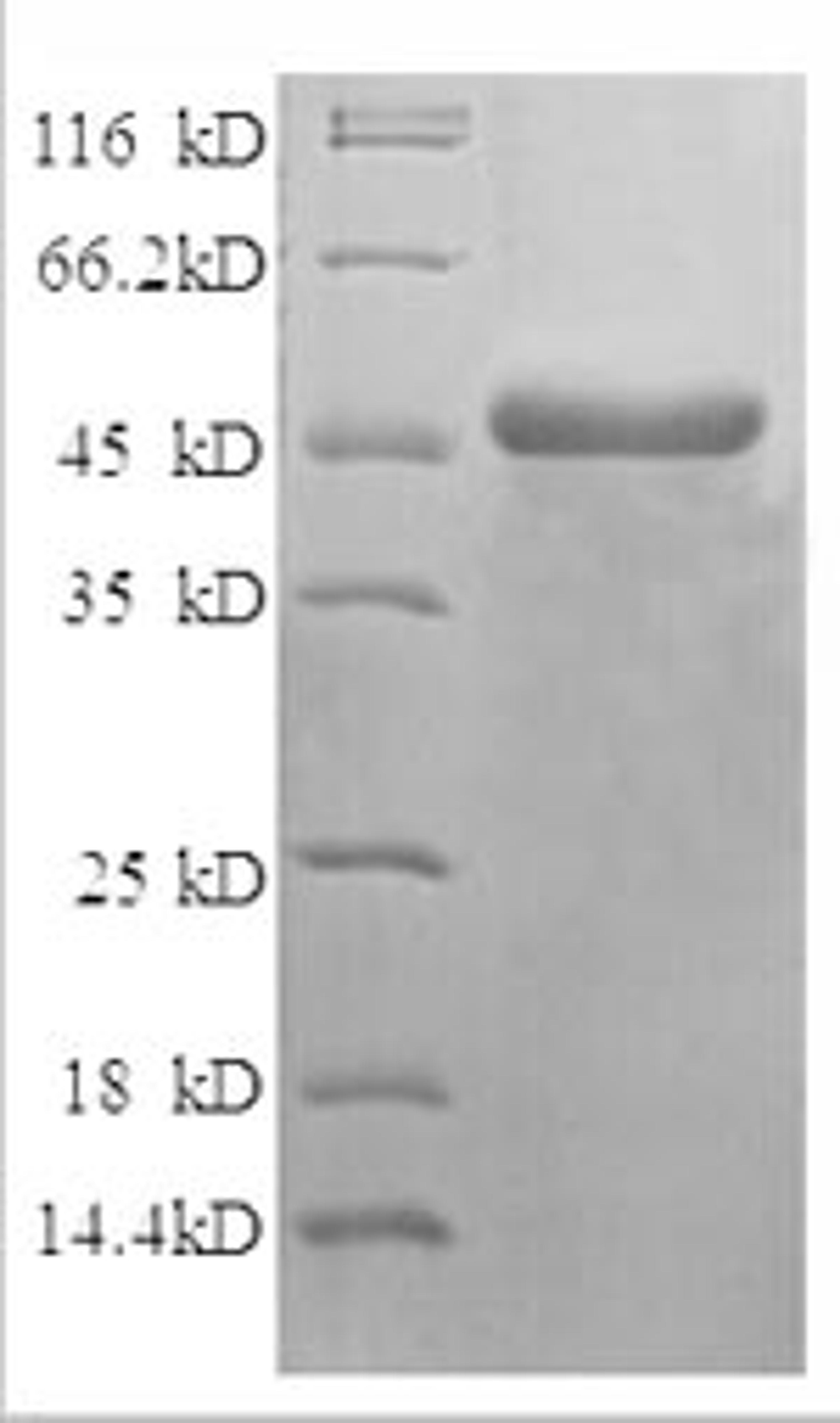 (Tris-Glycine gel) Discontinuous SDS-PAGE (reduced) with 5% enrichment gel and 15% separation gel.