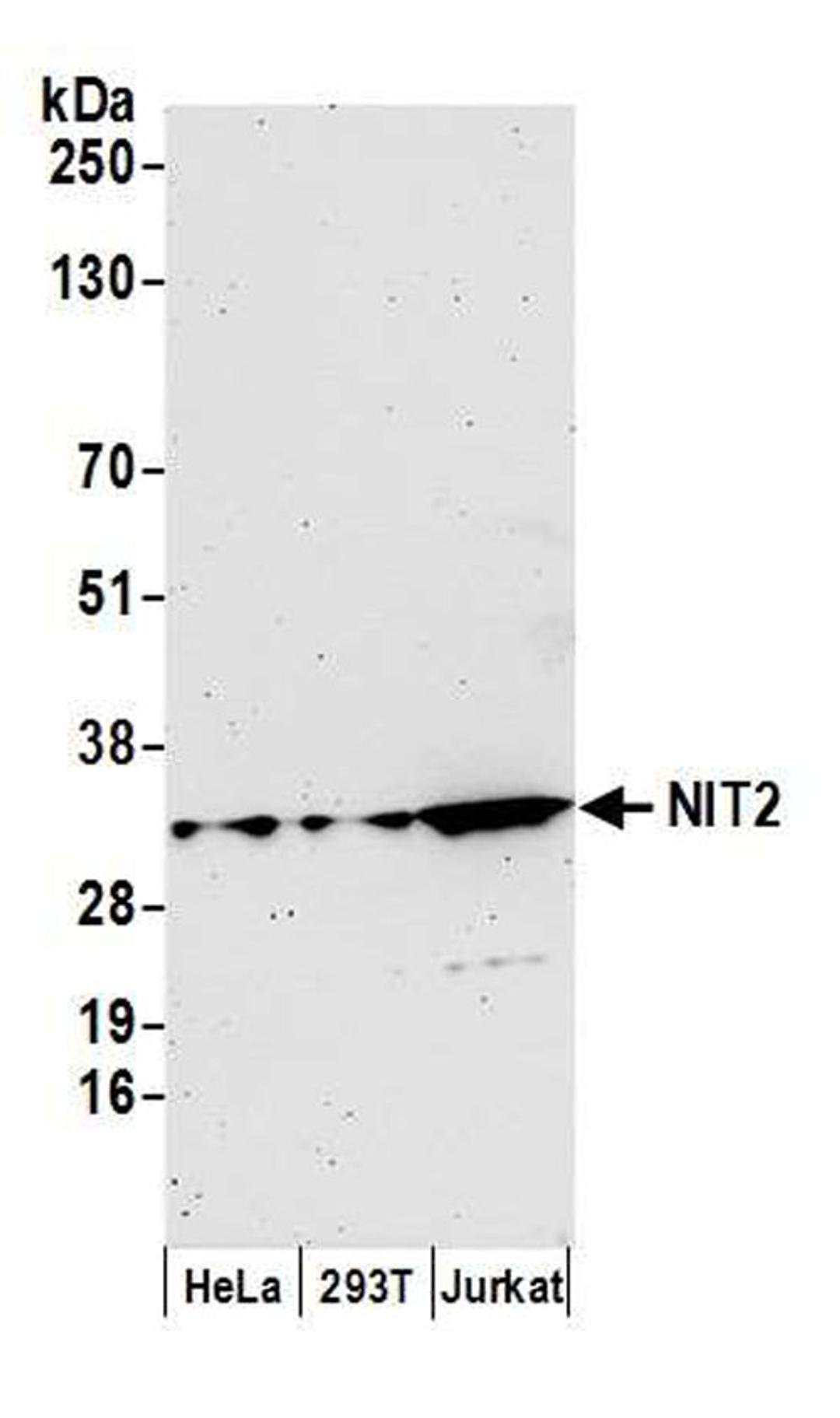 Detection of human NIT2 by WB.