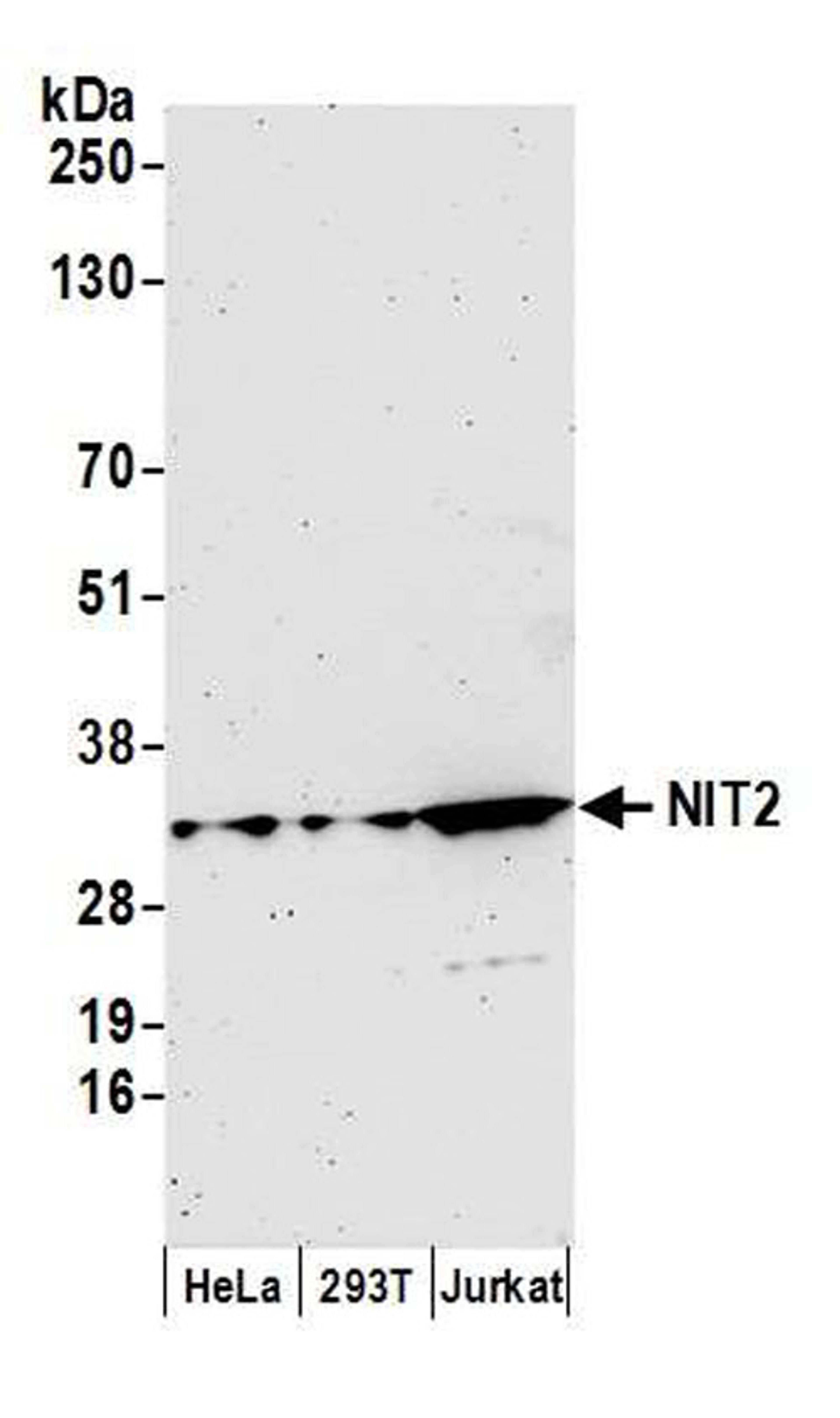 Detection of human NIT2 by WB.