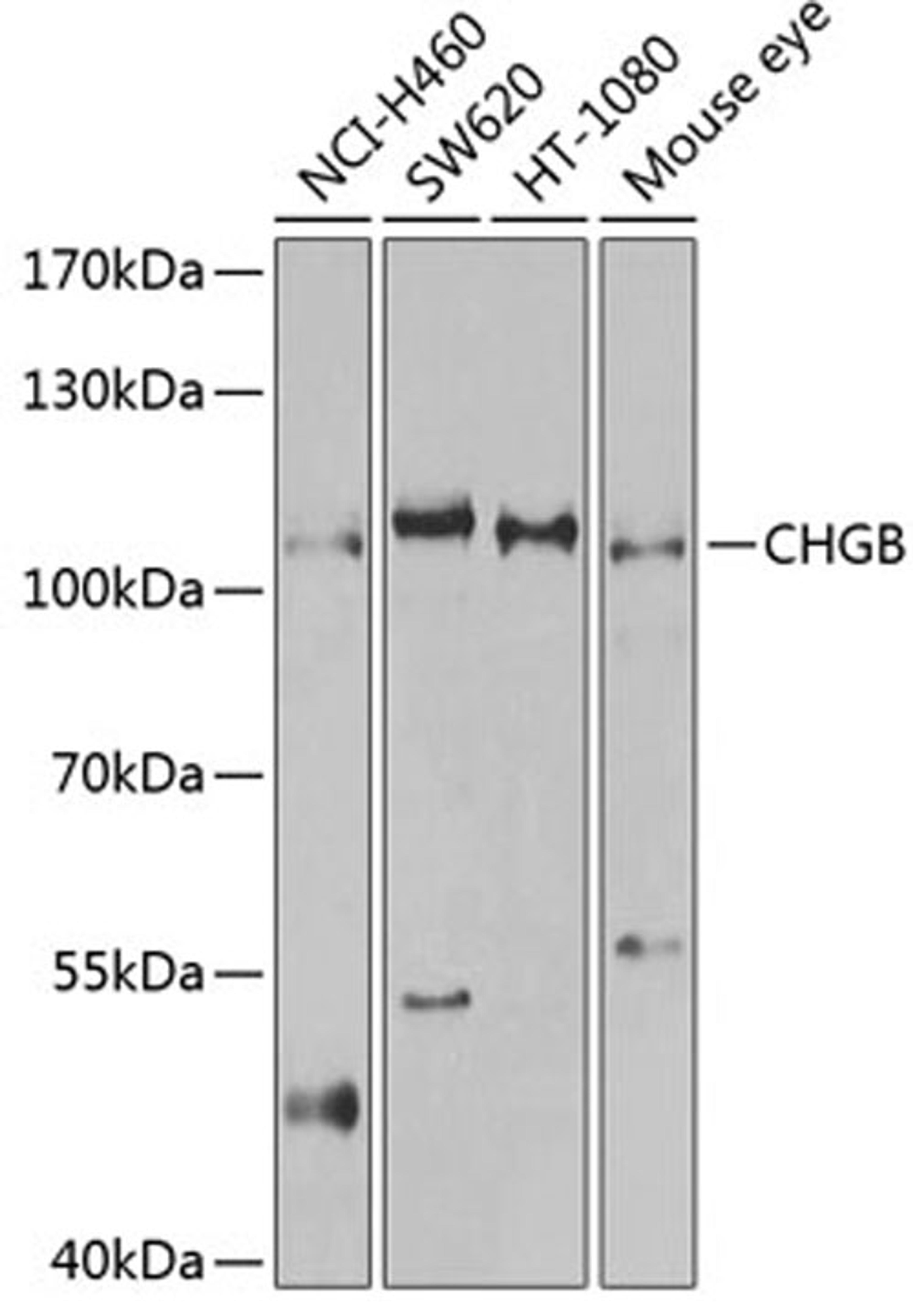 Western blot - CHGB antibody (A2864)