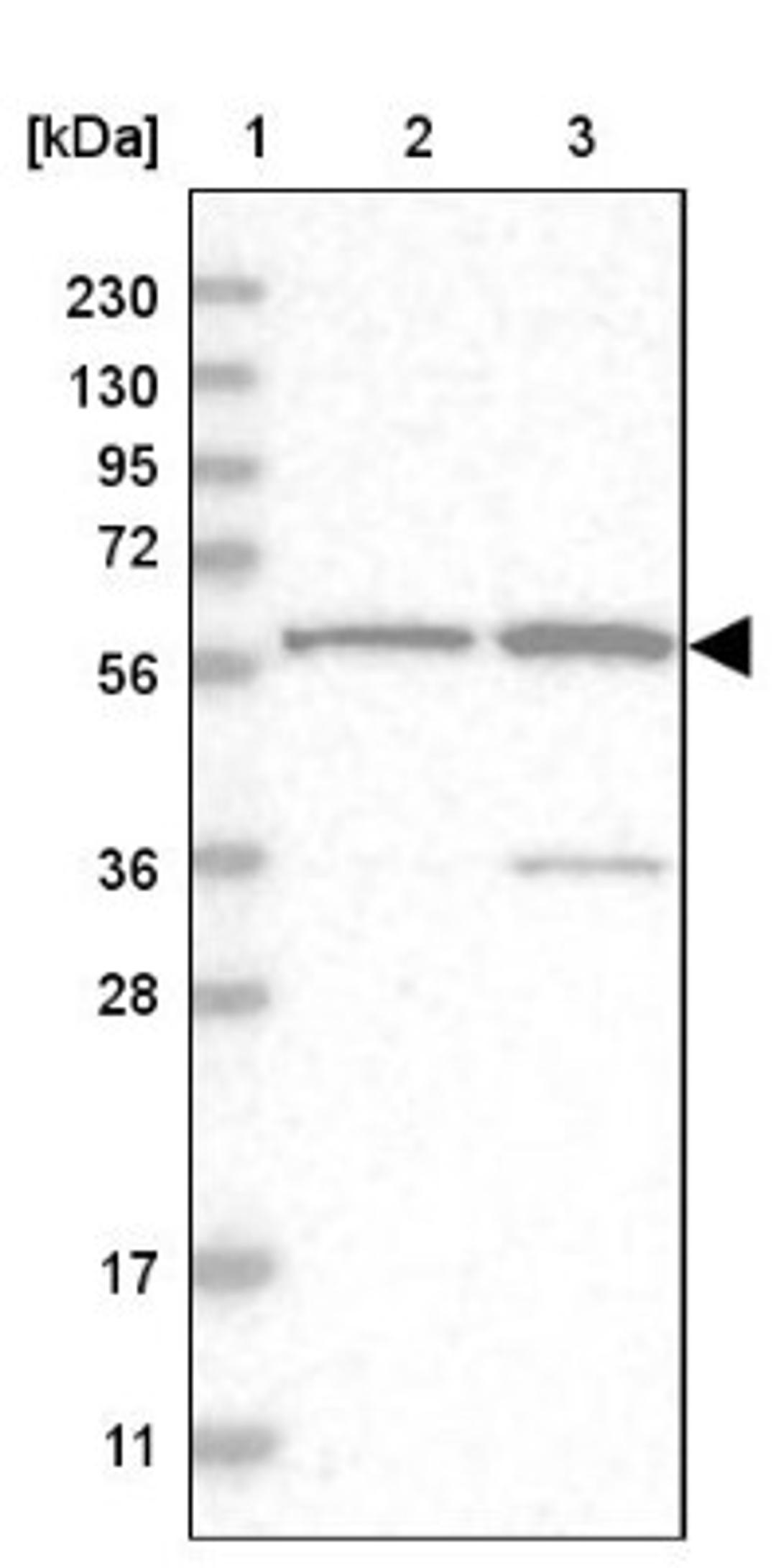 Western Blot: ZNF250 Antibody [NBP1-81052] - Lane 1: Marker [kDa] 230, 130, 95, 72, 56, 36, 28, 17, 11<br/>Lane 2: Human cell line RT-4<br/>Lane 3: Human cell line U-251MG sp