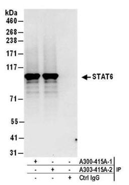 Detection of human STAT6 by western blot of immunoprecipitates.