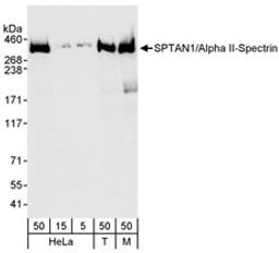 Detection of human and mouse SPTAN1/Alpha II-Spectrin by western blot.