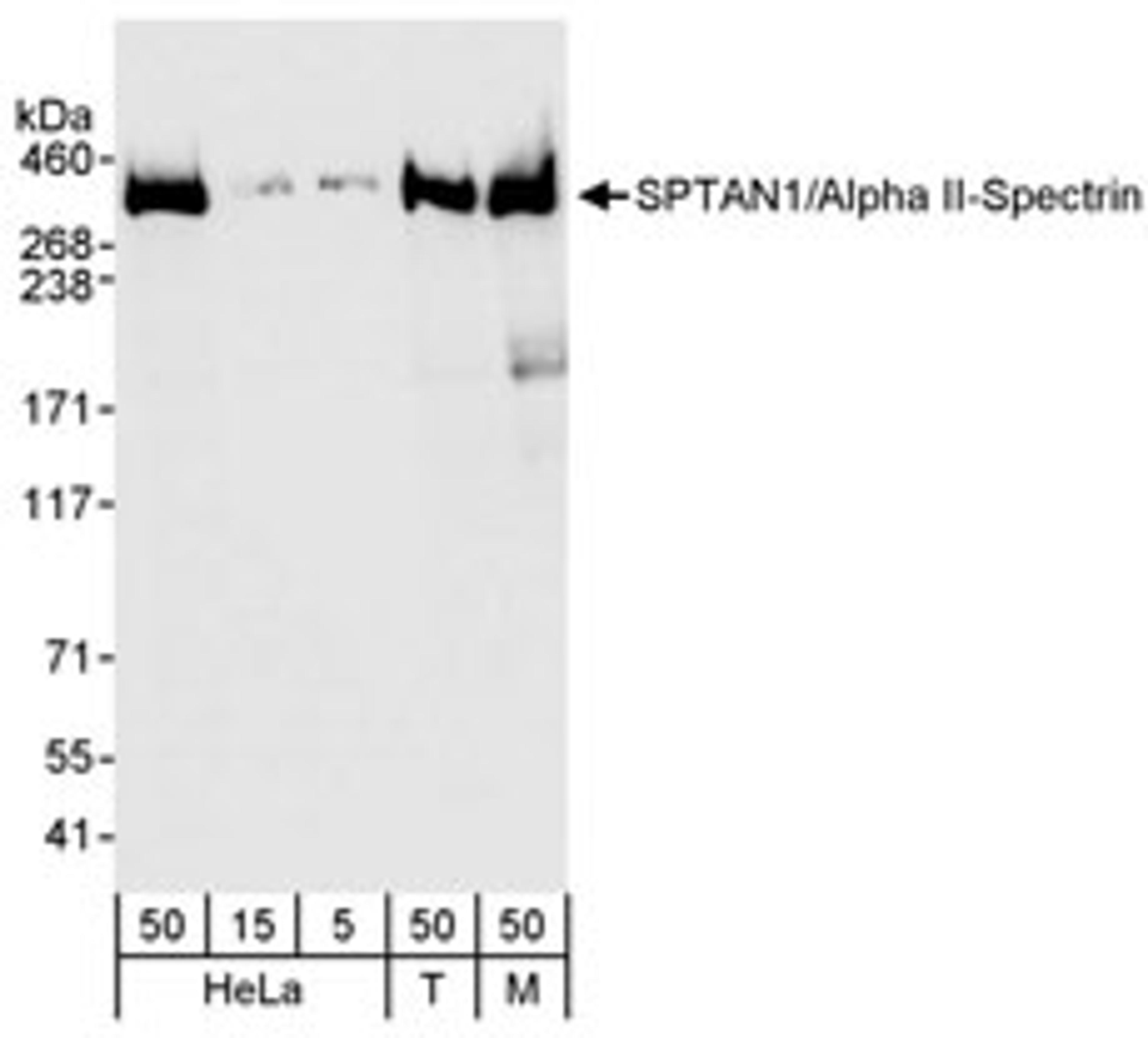 Detection of human and mouse SPTAN1/Alpha II-Spectrin by western blot.