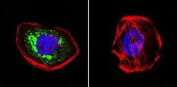 Immunocytochemistry/Immunofluorescence: Hsp70 interacting protein HIP Antibody (2G6) [NB120-2813] - Analysis of HIP in A431 cells. Cells were grown on chamber slides and fixed with formaldehyde prior to staining. Cells were probed without (control) or with a HIP monoclonal antibody at a dilution of 1:100 overnight at 4C, washed with PBS and incubated with a DyLight-488 conjugated secondary antibody. HIP staining (green), F-Actin staining with Phalloidin (red) and nuclei with DAPI (blue) is shown. Images were taken at 60X magnification.