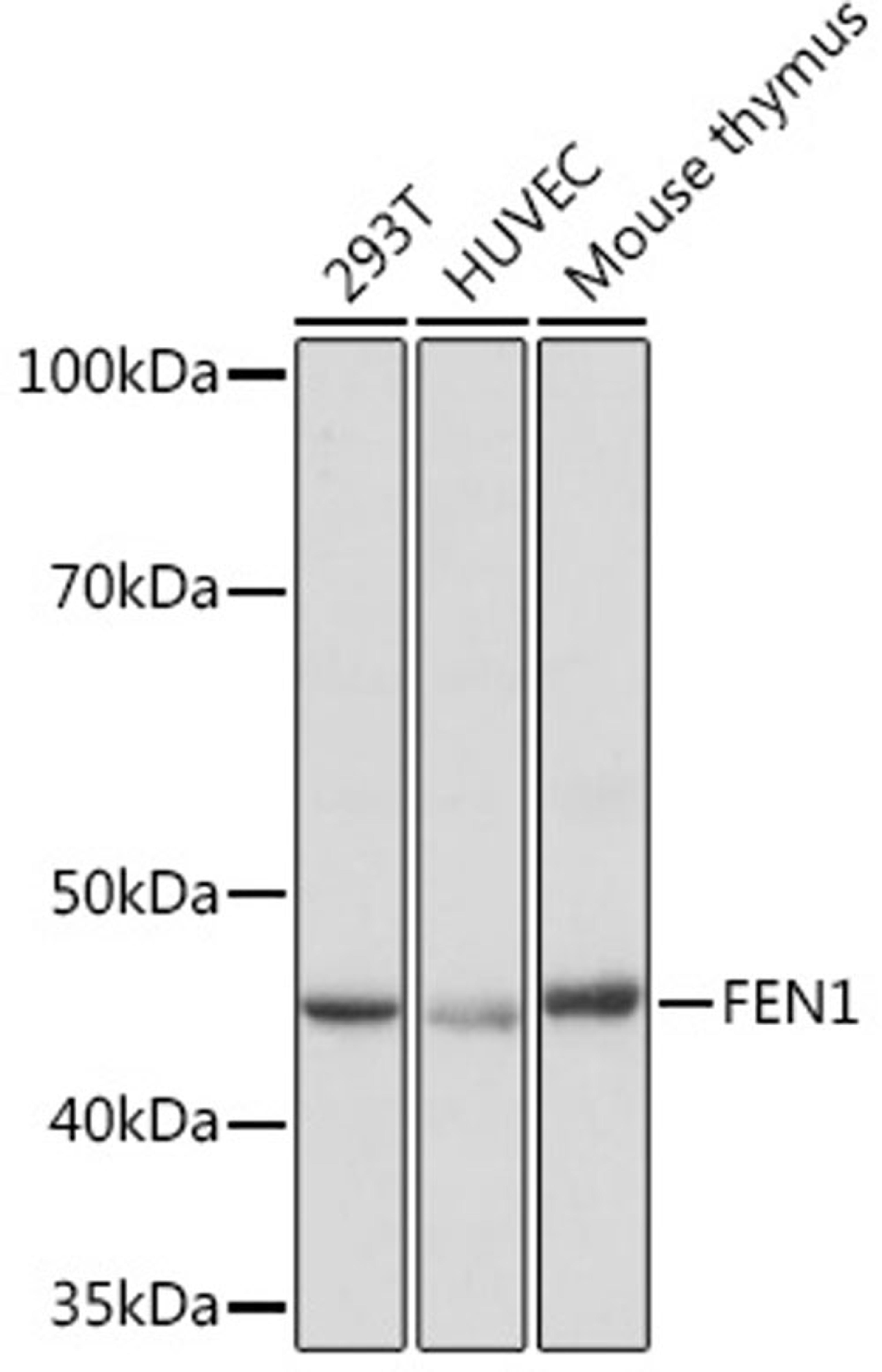 Western blot - FEN1 Rabbit mAb (A8999)