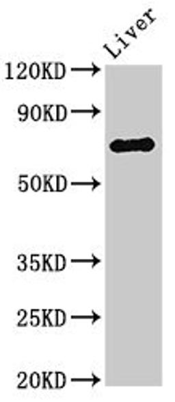 Western Blot. Positive WB detected in: Rat liver tissue. All lanes: PRODH antibody at 3ug/ml. Secondary. Goat polyclonal to rabbit IgG at 1/50000 dilution. Predicted band size: 69, 57, 60 kDa. Observed band size: 69 kDa. 