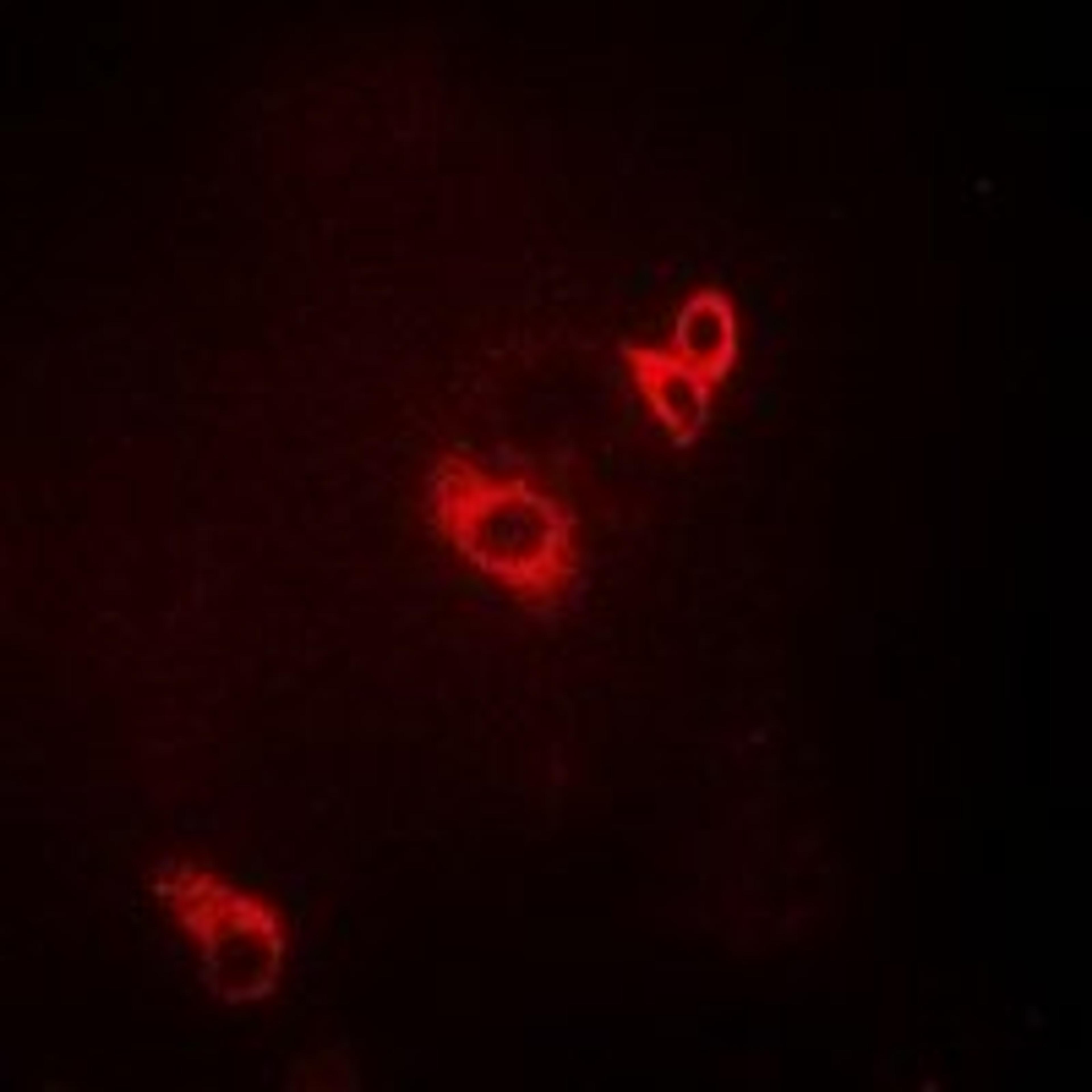 Immunofluorescent analysis of MCF7 cells using ACAD9 antibody