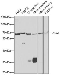 Western blot - ALG1 antibody (A7818)