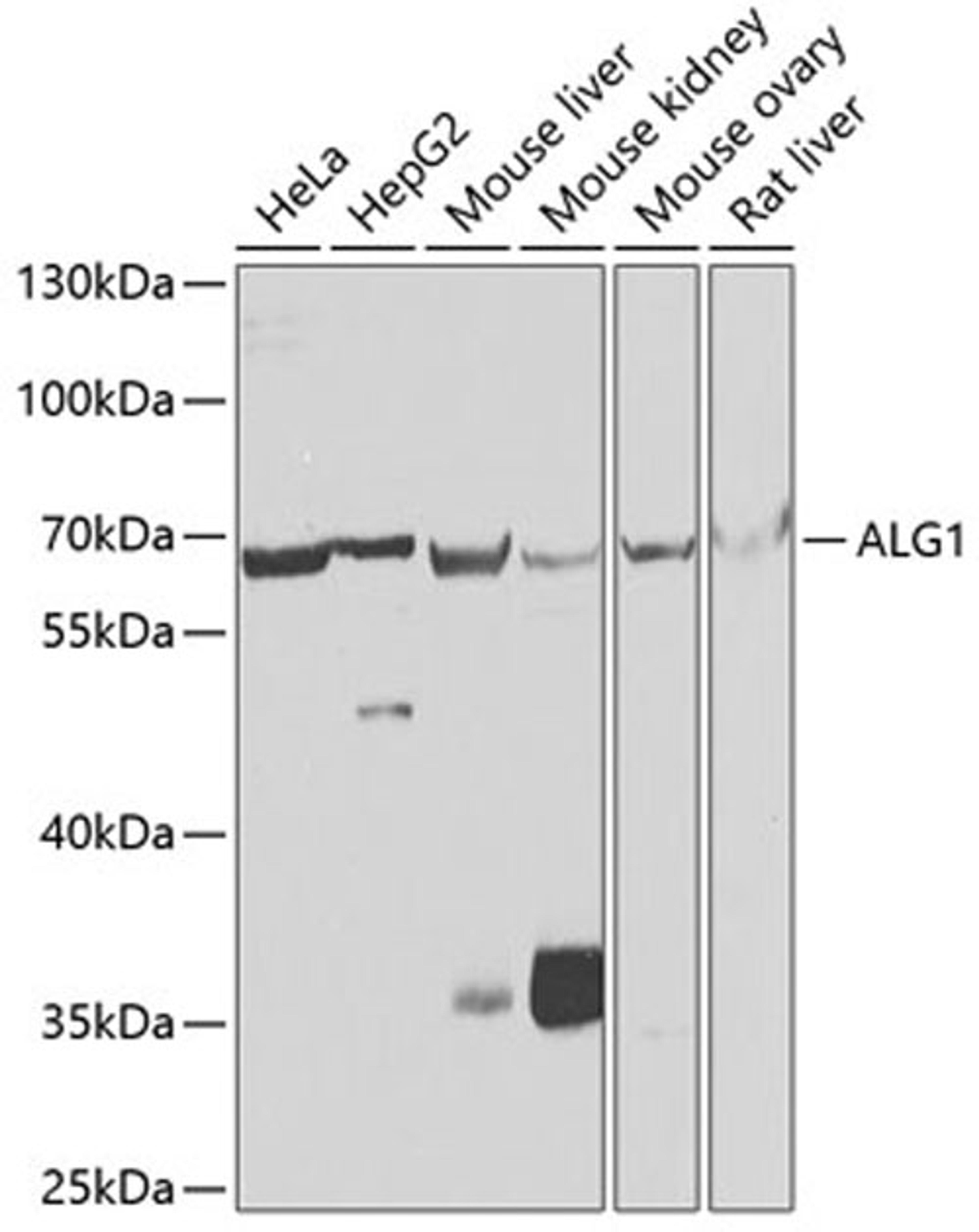 Western blot - ALG1 antibody (A7818)