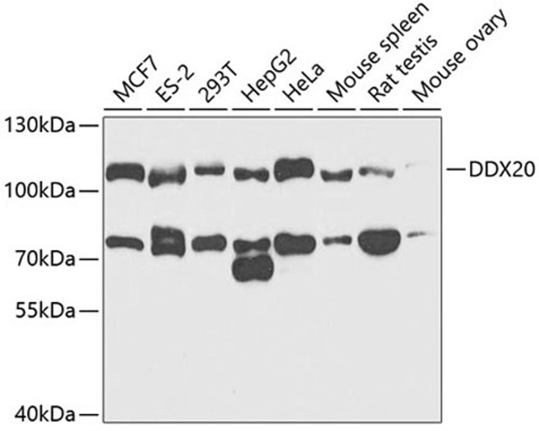 Western blot - DDX20 antibody (A5817)