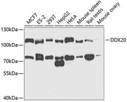 Western blot - DDX20 antibody (A5817)