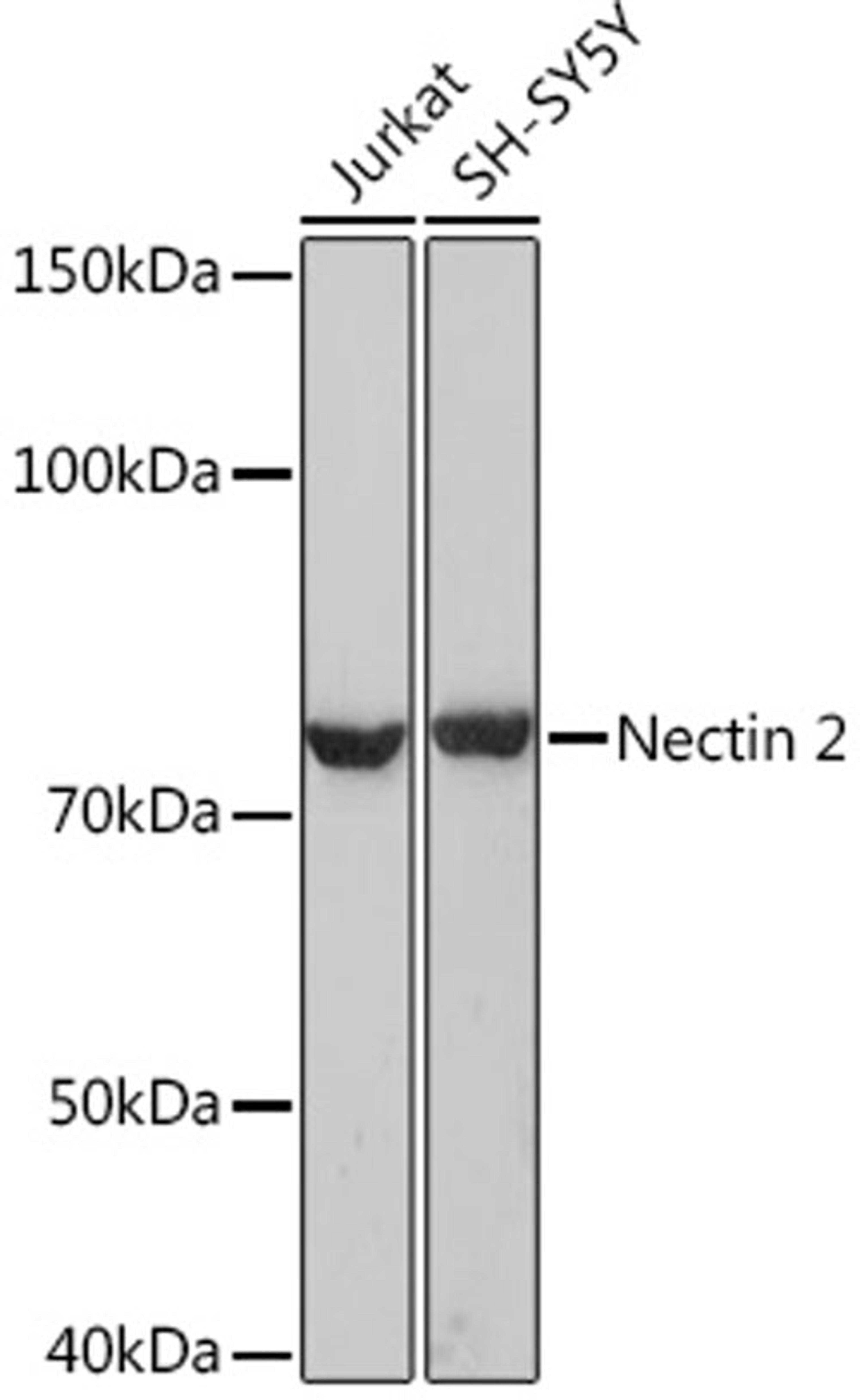 Western blot - Nectin 2 Rabbit mAb (A9622)