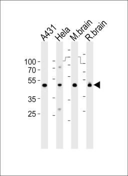 Western blot analysis of lysates from A431, Hela cell line, mouse brain and rat brain tissue lysate(from left to right), using NDUFS2 Antibody at 1:1000 at each lane.