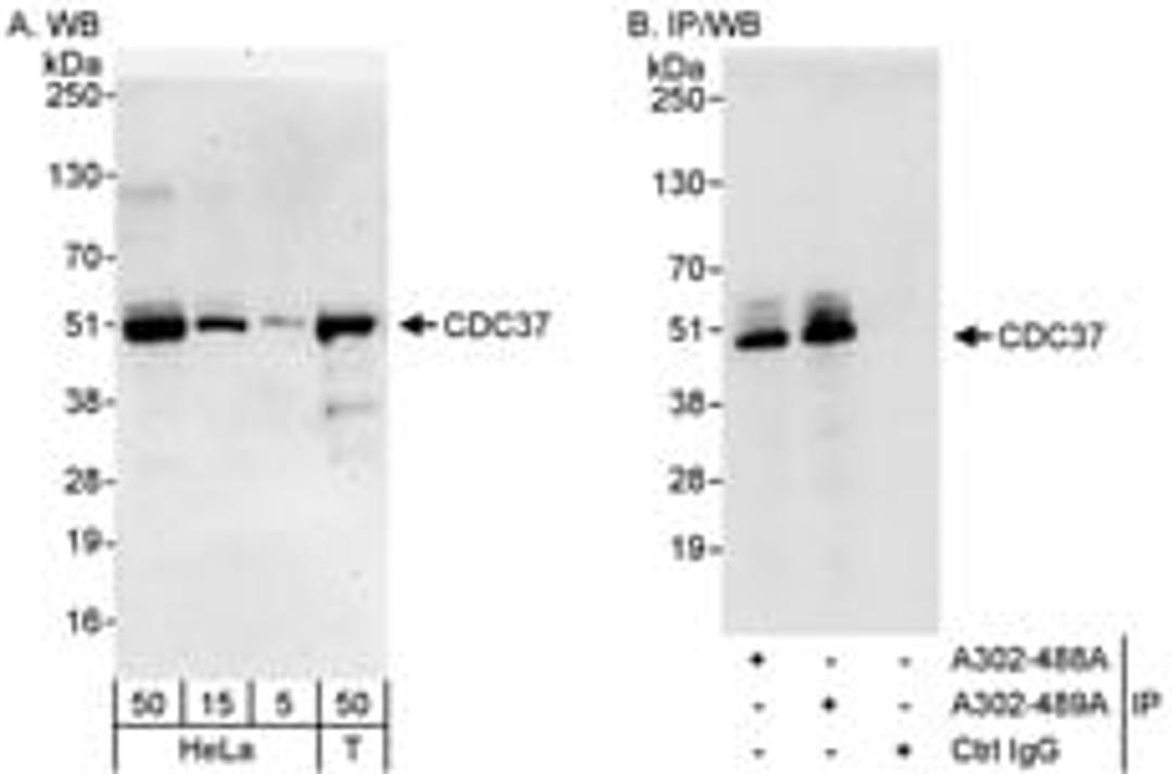 Detection of human CDC37 by western blot and immunoprecipitation.