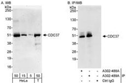 Detection of human CDC37 by western blot and immunoprecipitation.