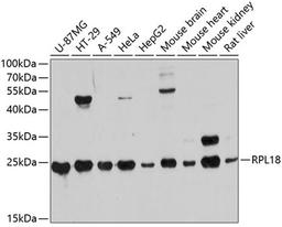 Western blot - RPL18 antibody (A10720)