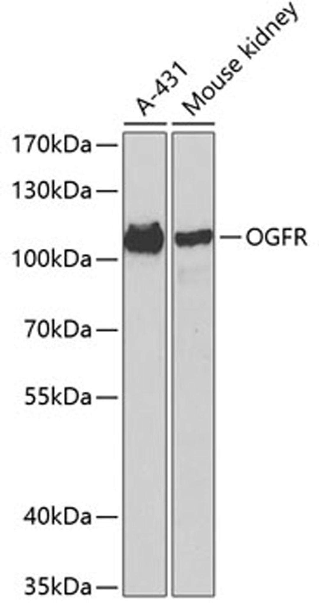 Western blot - OGFR antibody (A7074)