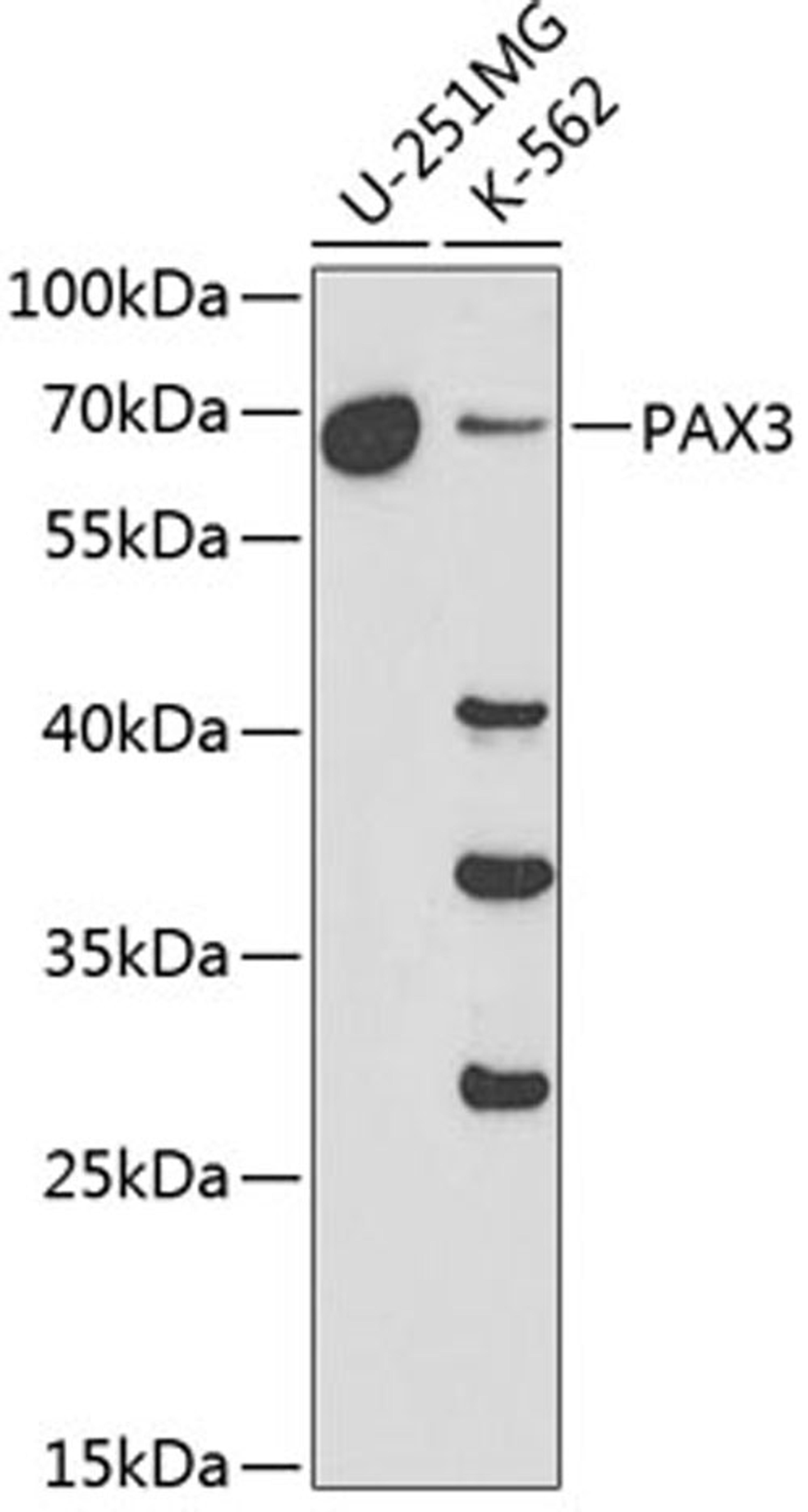 Western blot - PAX3 antibody (A1675)