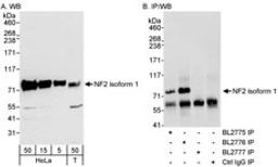 Detection of Isoform 1 of human NF2 by western blot and immunoprecipitation.