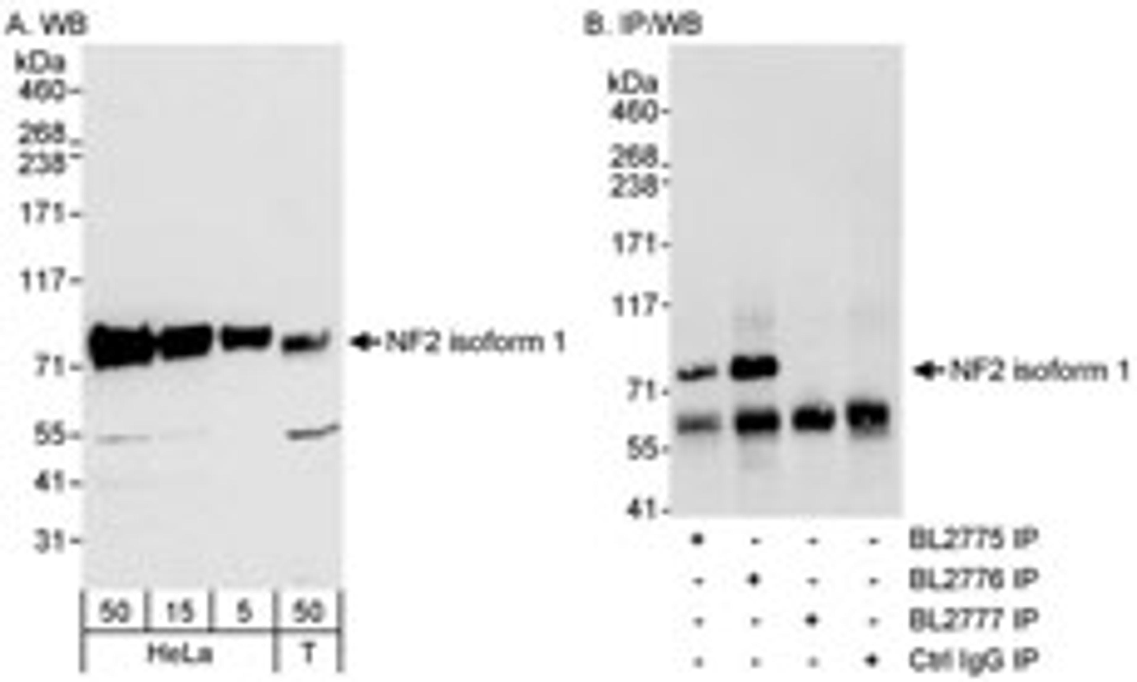 Detection of Isoform 1 of human NF2 by western blot and immunoprecipitation.