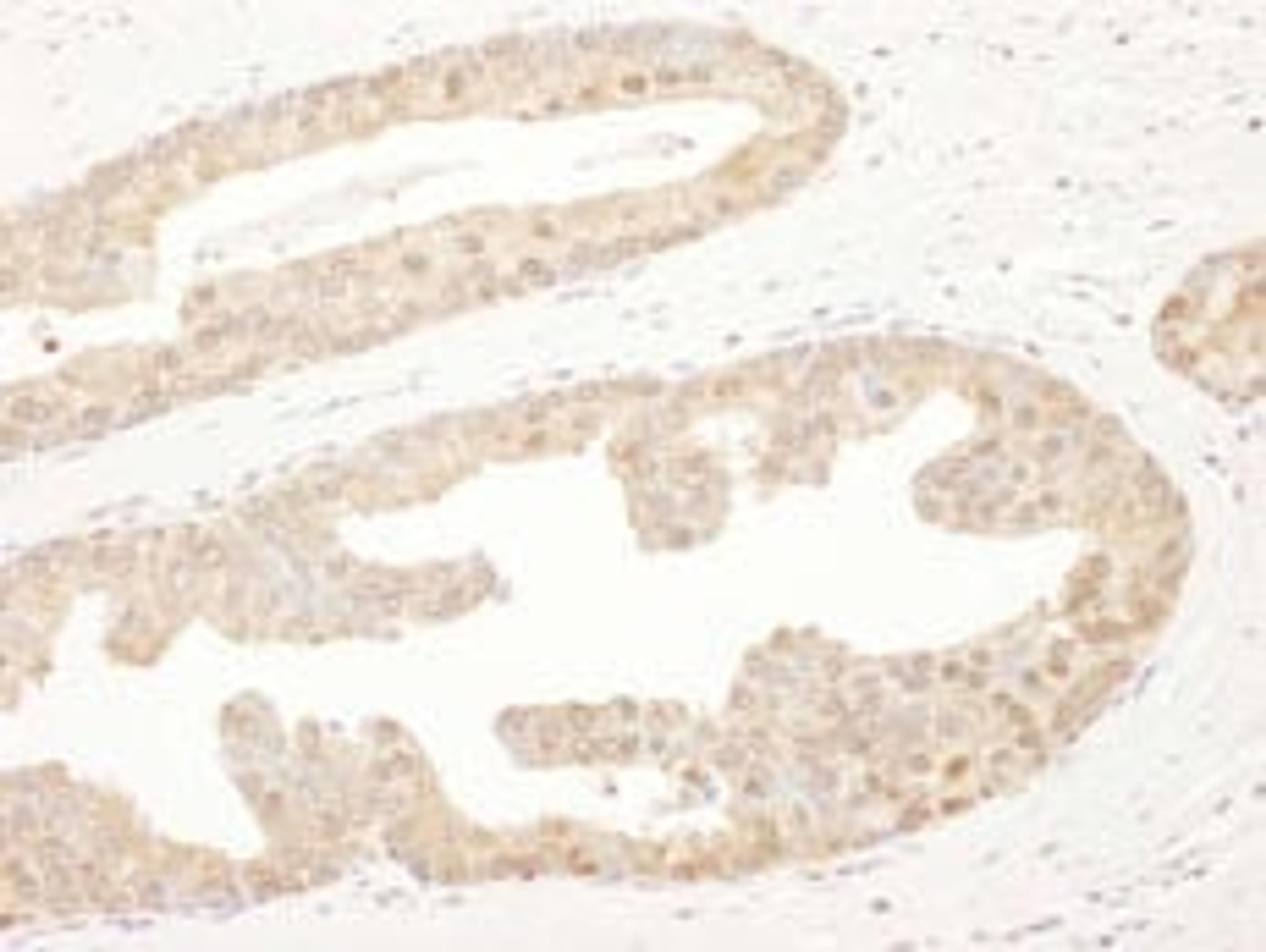 Detection of human PSMA6 by immunohistochemistry.