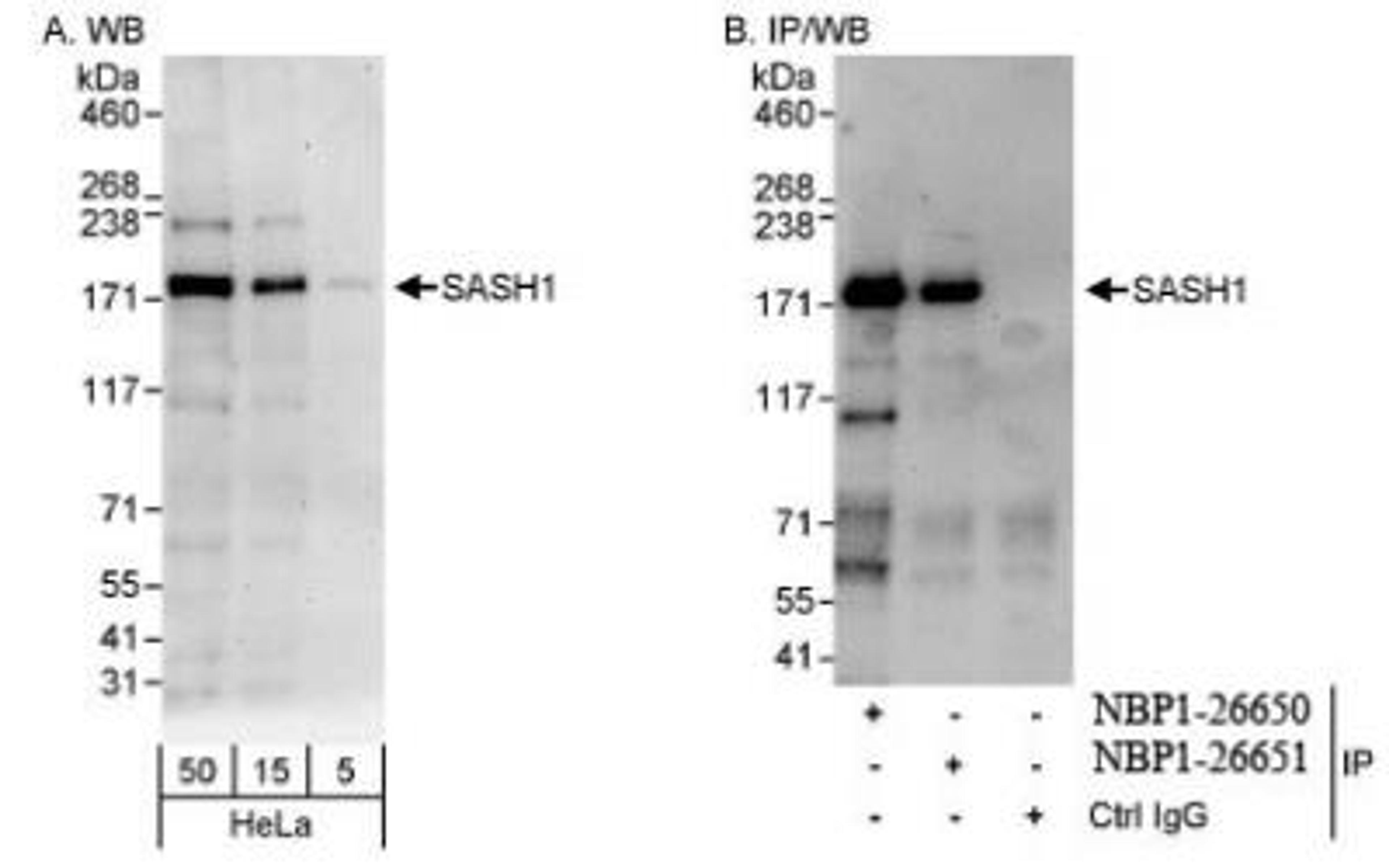 Western Blot: SASH1 Antibody [NBP1-26650] - Whole cell lysate from HeLa cells. SASH1 was also immunoprecipitated by rabbit anti-SASH1 antibody NBP1-26651.