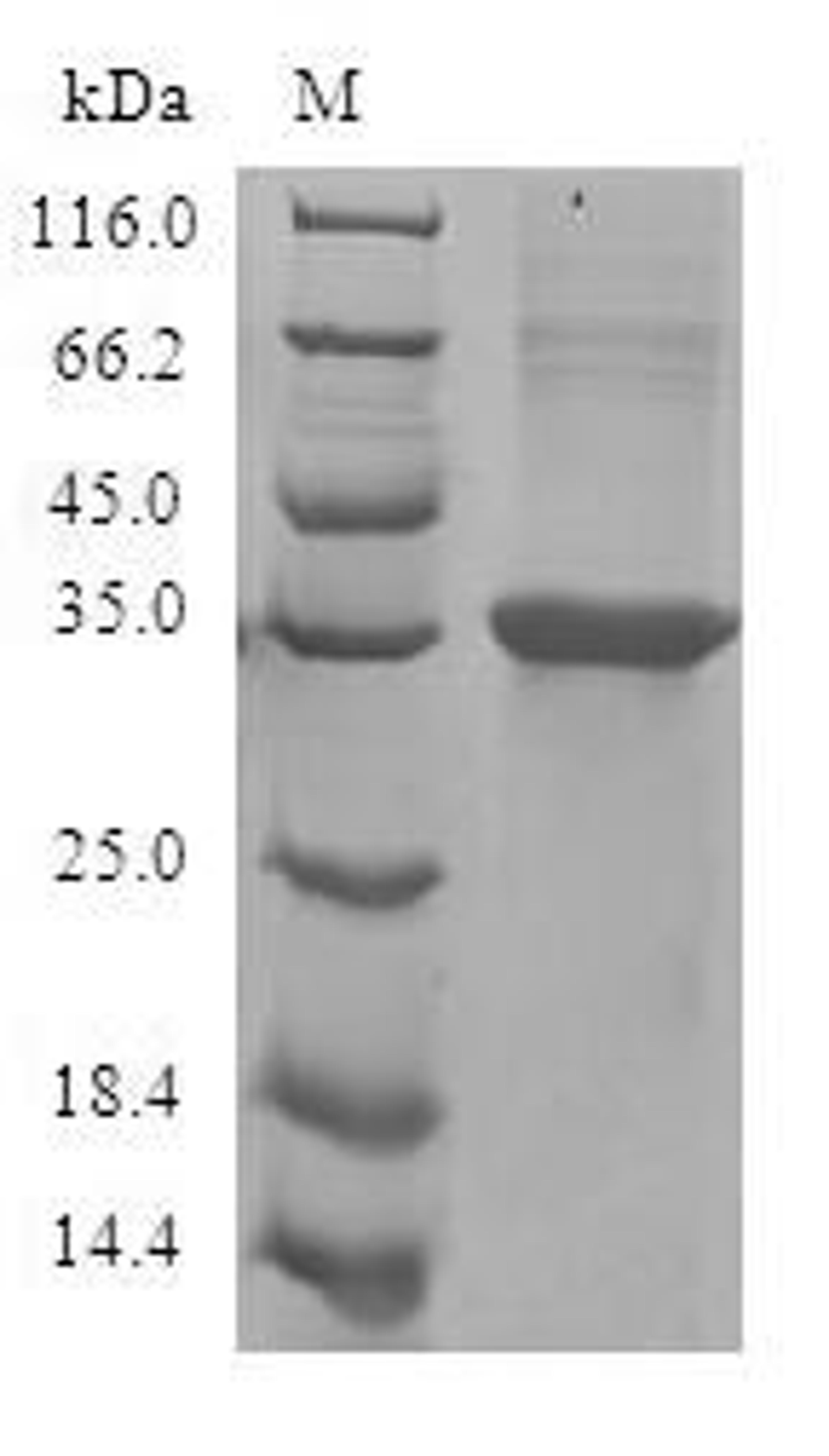 (Tris-Glycine gel) Discontinuous SDS-PAGE (reduced) with 5% enrichment gel and 15% separation gel.