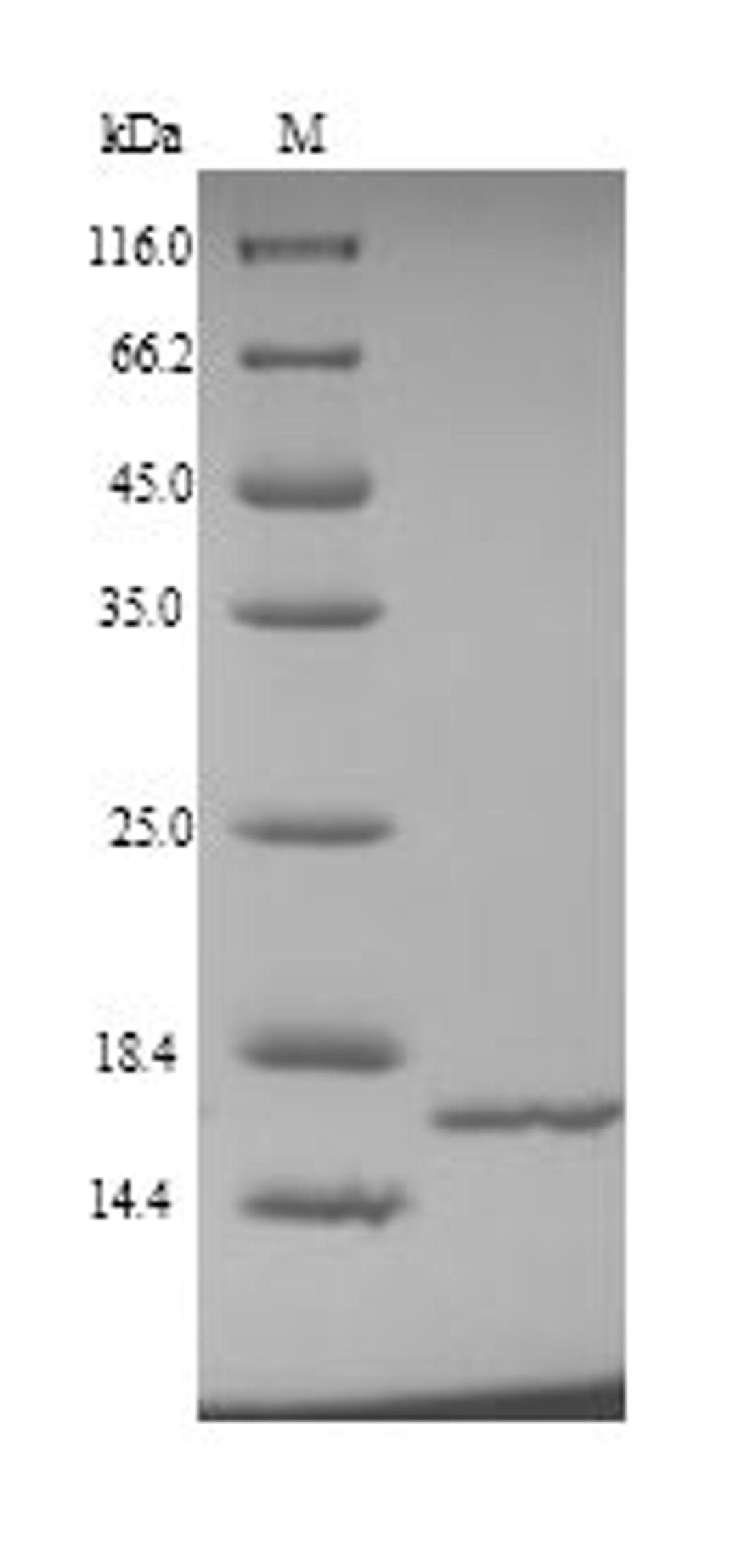 (Tris-Glycine gel) Discontinuous SDS-PAGE (reduced) with 5% enrichment gel and 15% separation gel.