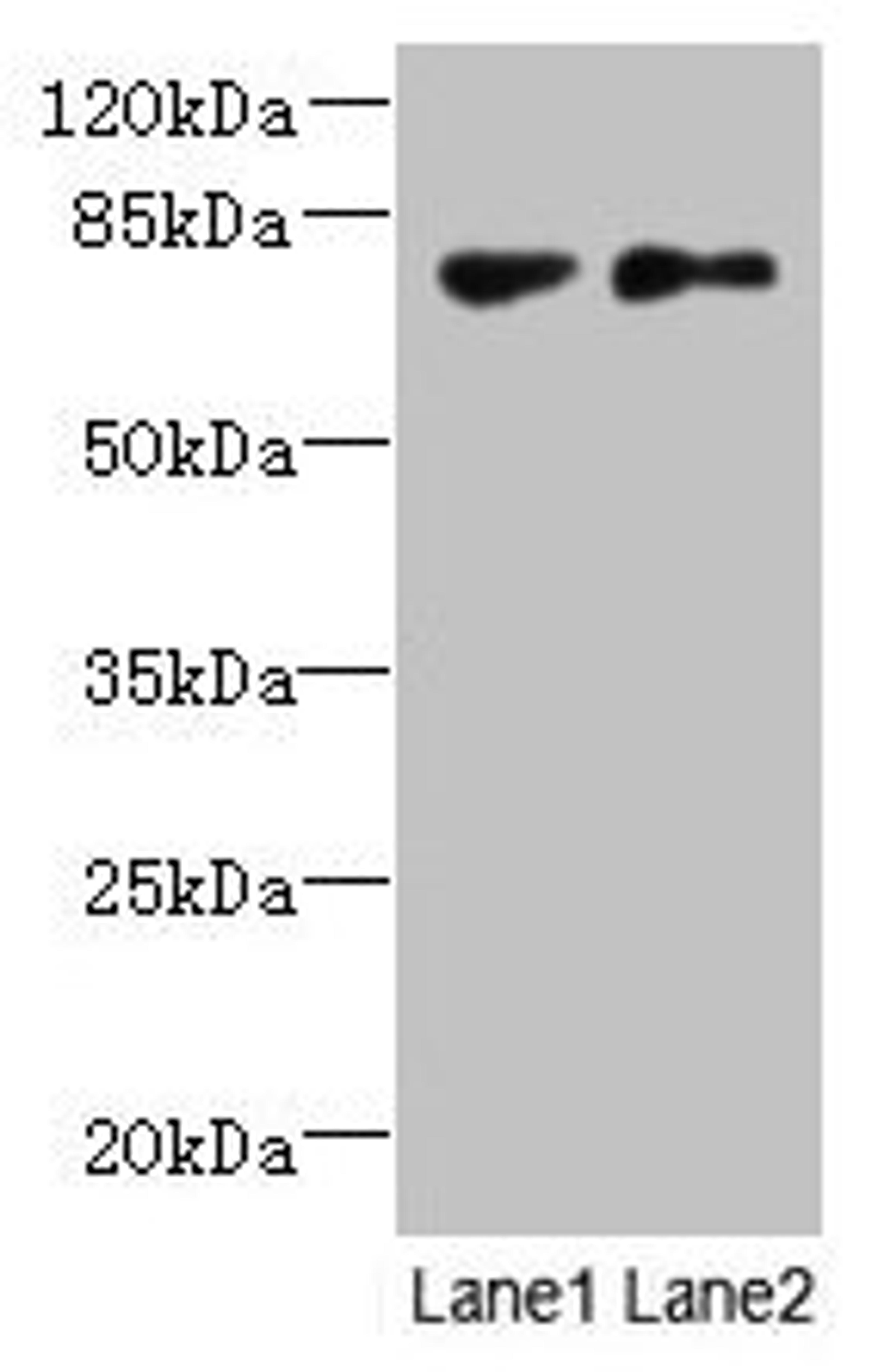 Western blot. All lanes: TTC30B antibody at 5µg/ml. Lane 1: MDA-MB-231 whole cell lysate. Lane 2: U251 whole cell lysate. Secondary. Goat polyclonal to rabbit IgG at 1/10000 dilution. Predicted band size: 77 kDa. Observed band size: 77 kDa