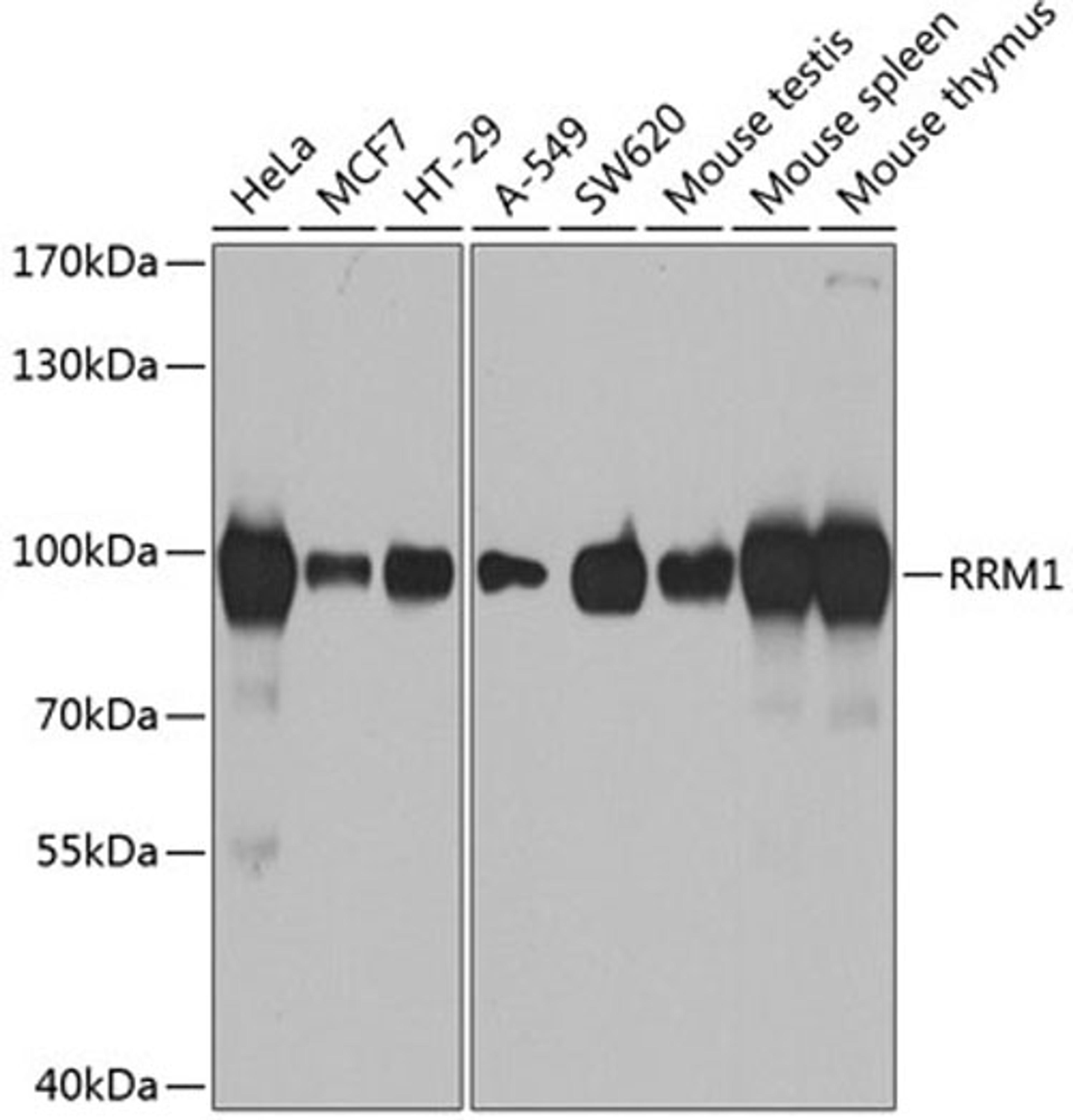 Western blot - RRM1 antibody (A1152)