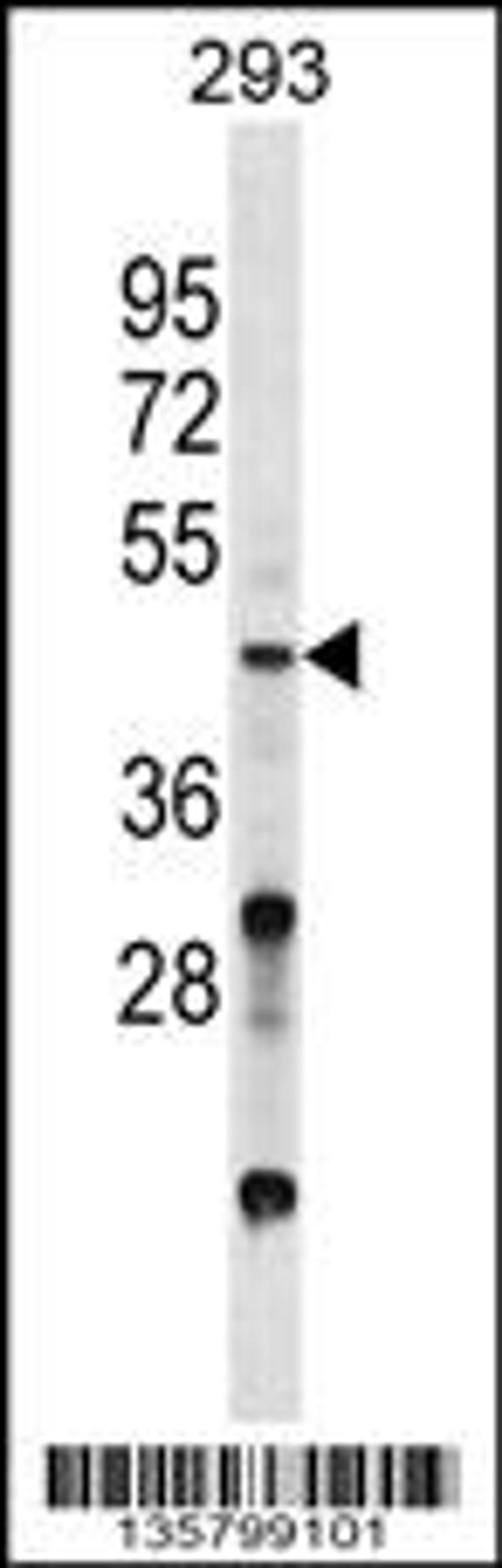 Western blot analysis in 293 cell line lysates (35ug/lane).