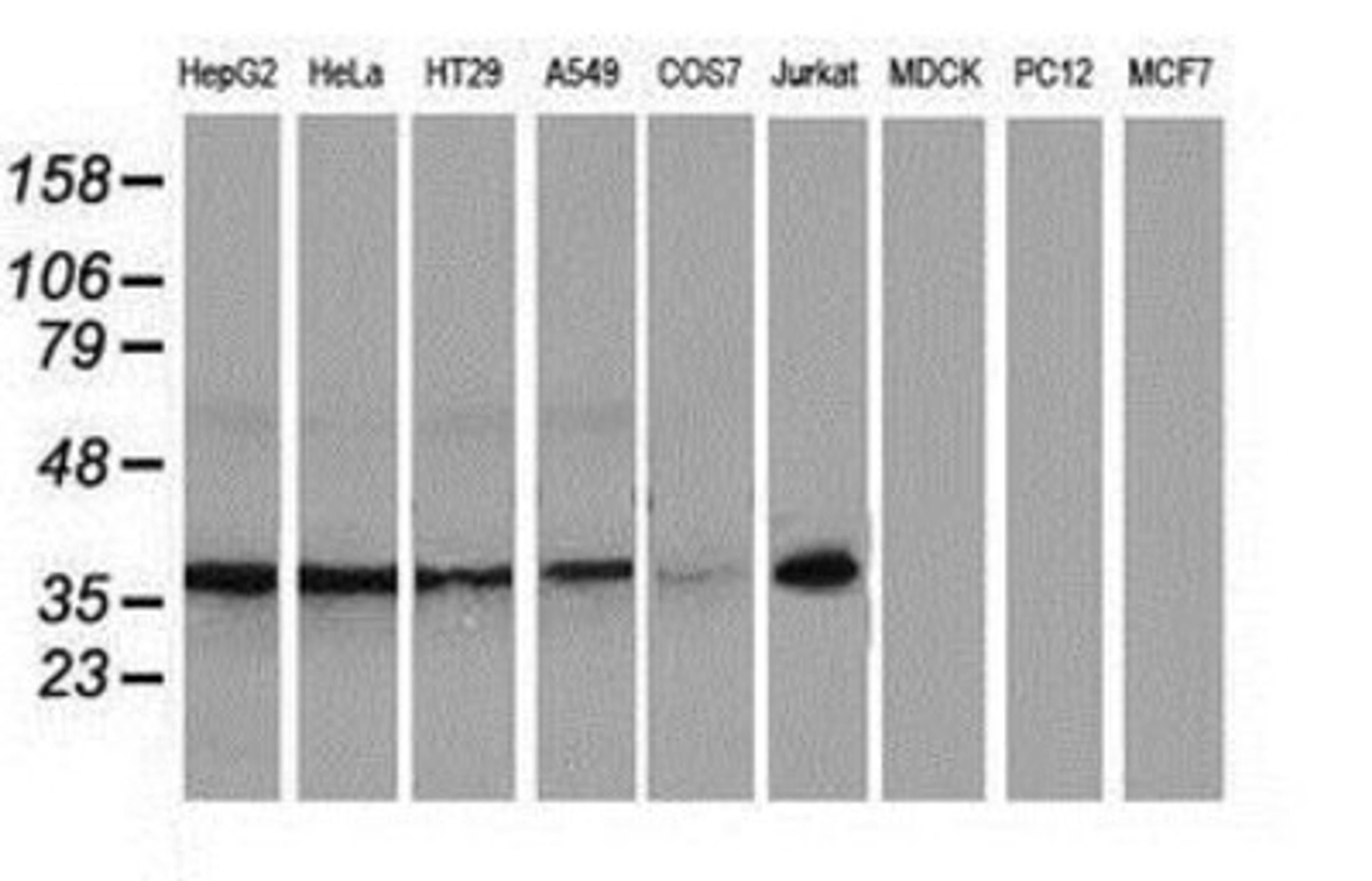 Western Blot: XLF Antibody (3D6) [NBP2-03275] Analysis of extracts (35ug) from 9 different cell lines by using anti-XLF monoclonal antibody.