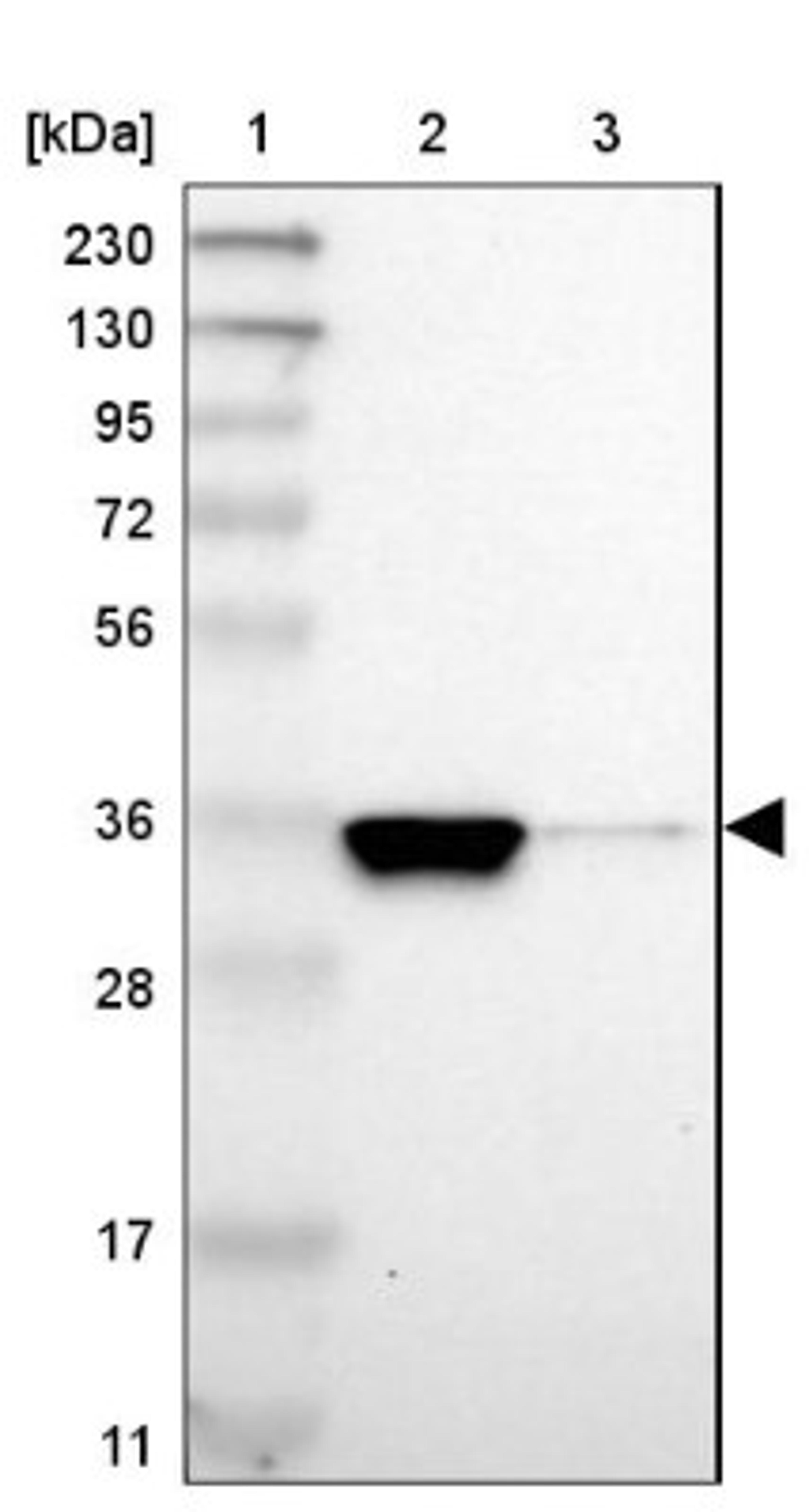 Western Blot: GJB1 Antibody [NBP1-85531] - Lane 1: Marker [kDa] 230, 130, 95, 72, 56, 36, 28, 17, 11<br/>Lane 2: Human cell line RT-4<br/>Lane 3: Human cell line U-251MG sp