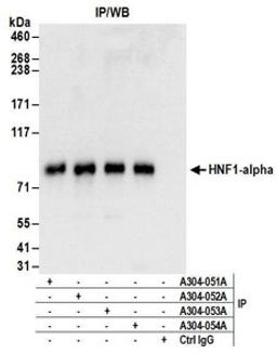 Detection of human HNF1-alpha by western blot of immunoprecipitates.