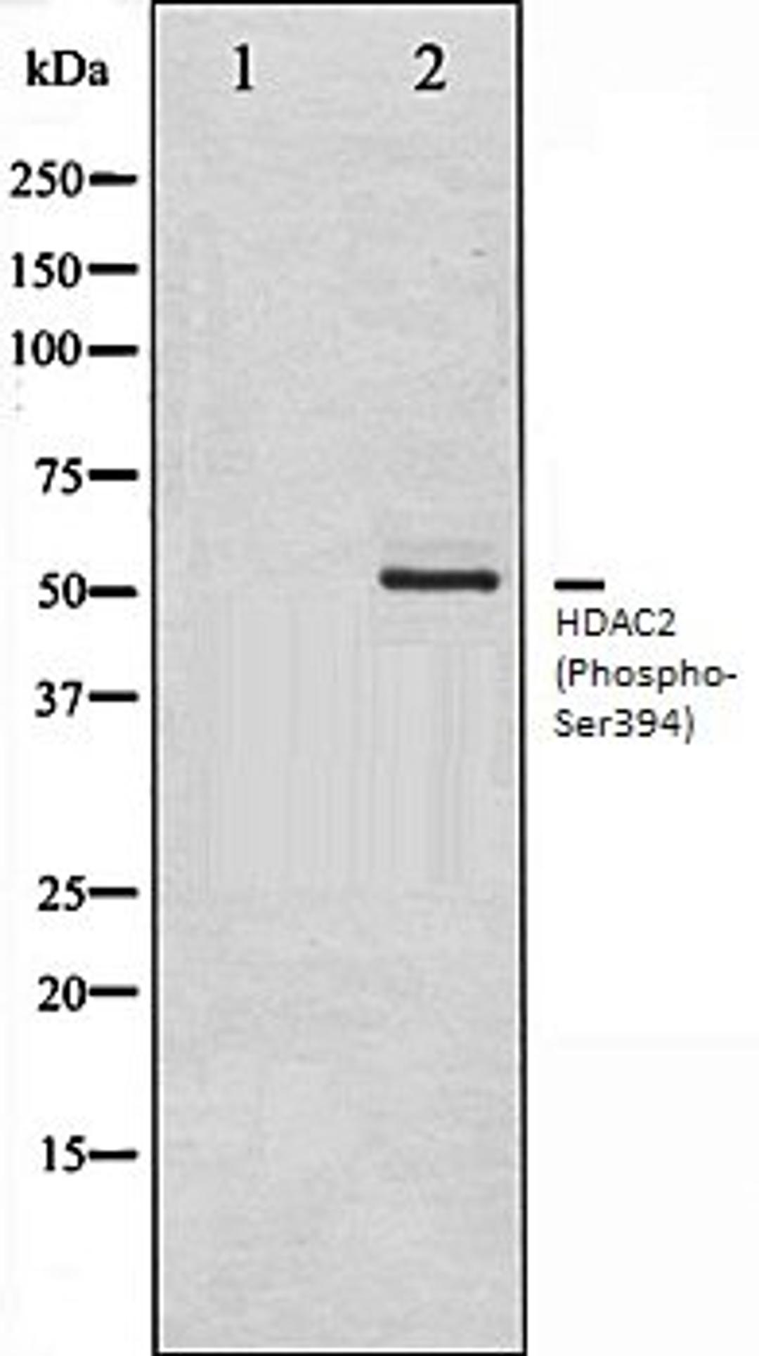 Western blot analysis of NIH-3T3 whole cell lysates using HDAC2 (Phospho-Ser394) antibody, The lane on the left is treated with the antigen-specific peptide.