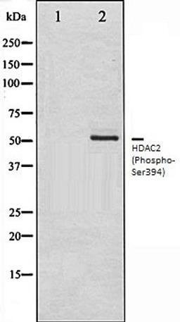 Western blot analysis of NIH-3T3 whole cell lysates using HDAC2 (Phospho-Ser394) antibody, The lane on the left is treated with the antigen-specific peptide.