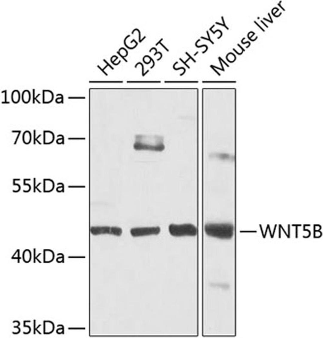 Western blot - WNT5B antibody (A8313)