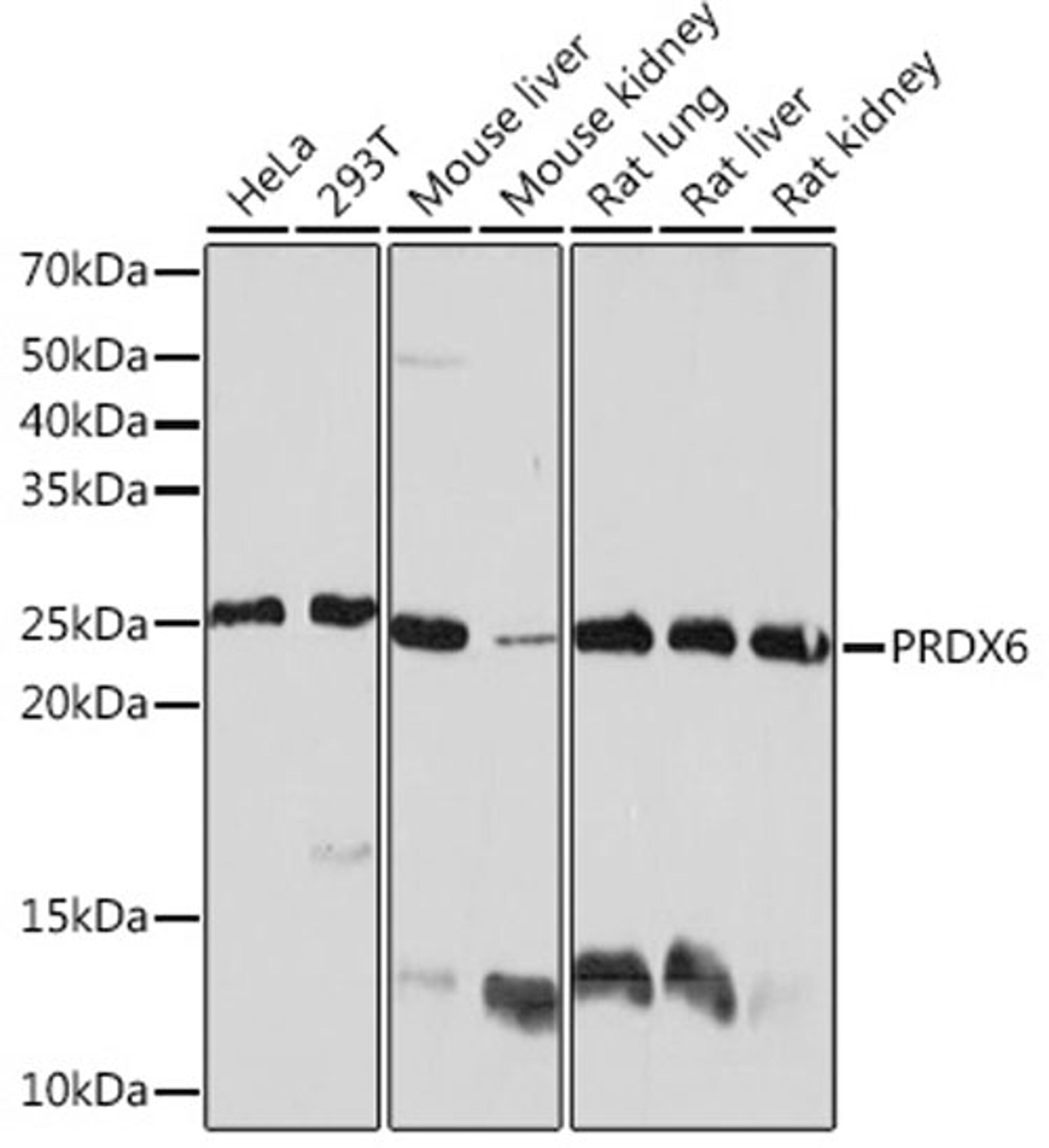 Western blot - PRDX6 Rabbit mAb (A4286)