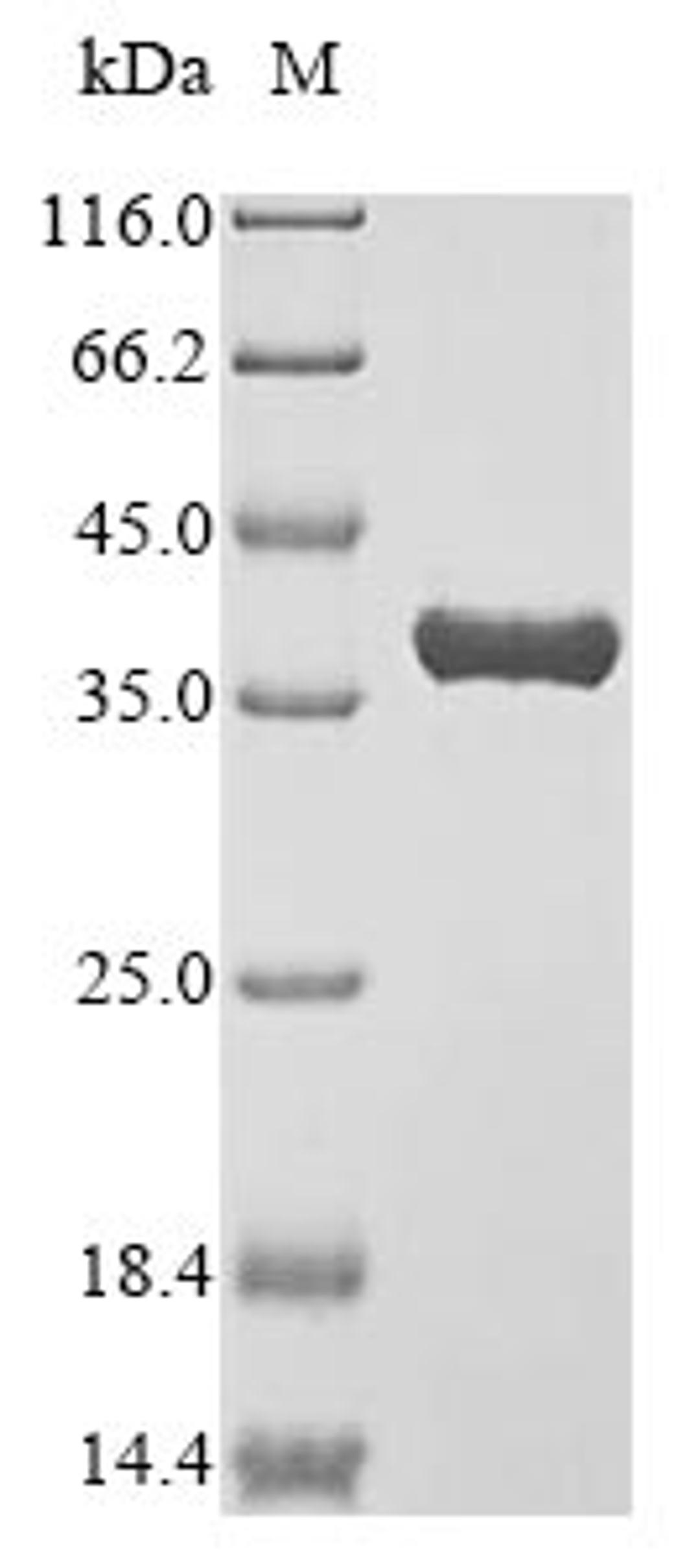 (Tris-Glycine gel) Discontinuous SDS-PAGE (reduced) with 5% enrichment gel and 15% separation gel.