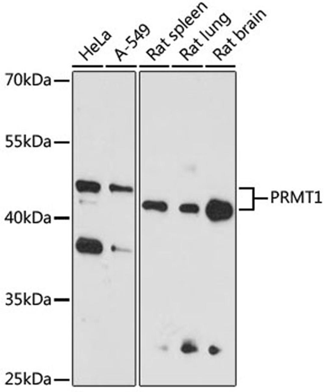 Western blot - PRMT1 antibody (A1055)