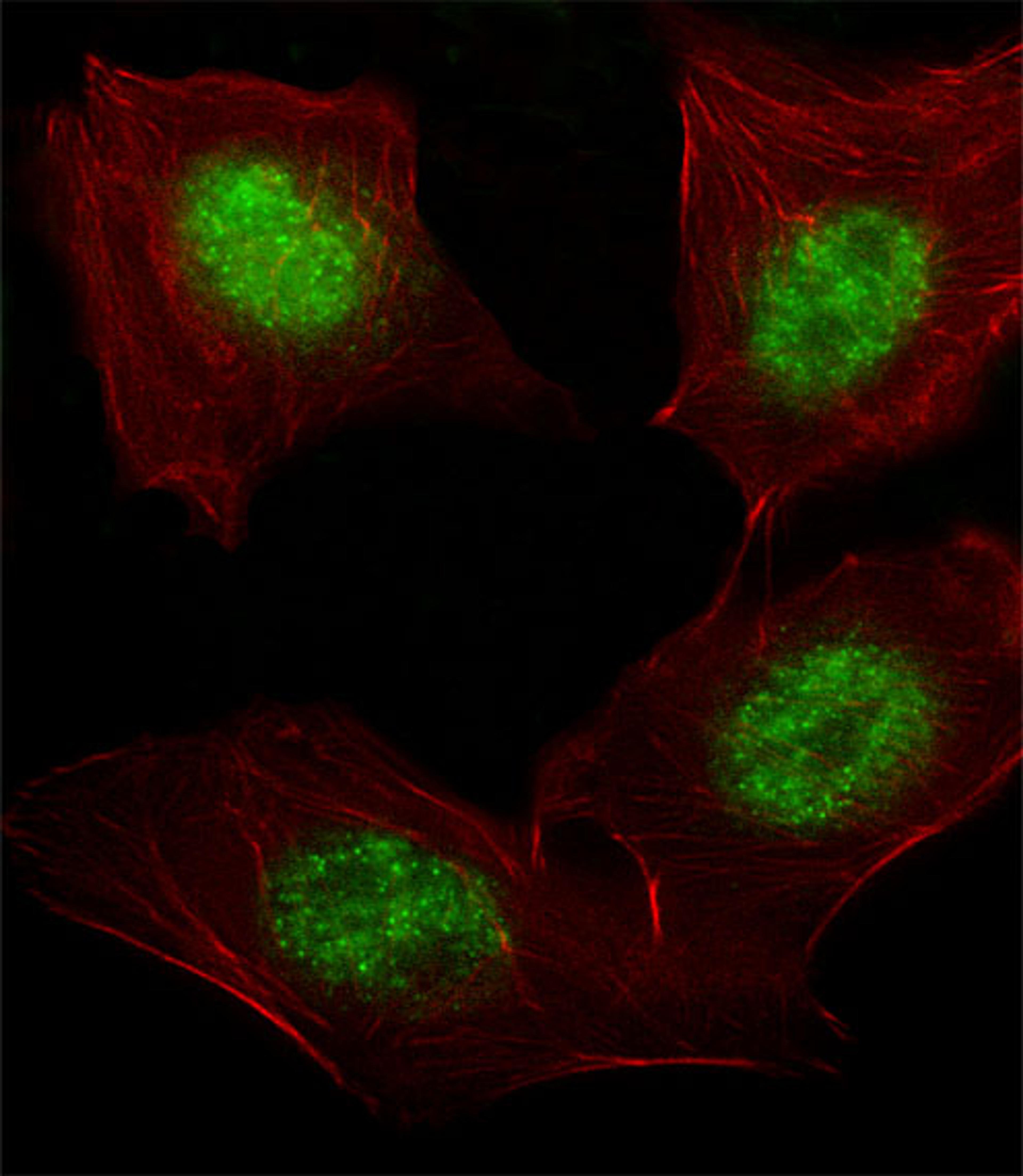 Fluorescent image of A549 cell stained with hARNT-V528.A549 cells were fixed with 4% PFA (20 min), permeabilized with Triton X-100 (0.1%, 10 min), then incubated with hARNT primary antibody (1:25). For secondary antibody, Alexa Fluor 488 conjugated donkey