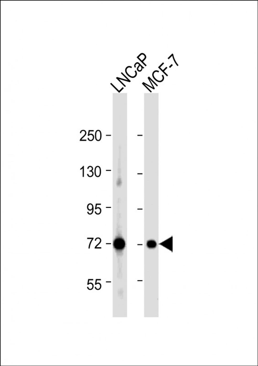 Western Blot at 1:1000 dilution Lane 1: LNCaP whole cell lysate Lane 2: MCF-7 whole cell lysate Lysates/proteins at 20 ug per lane.