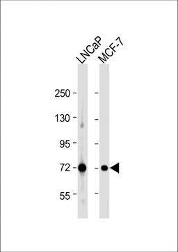 Western Blot at 1:1000 dilution Lane 1: LNCaP whole cell lysate Lane 2: MCF-7 whole cell lysate Lysates/proteins at 20 ug per lane.