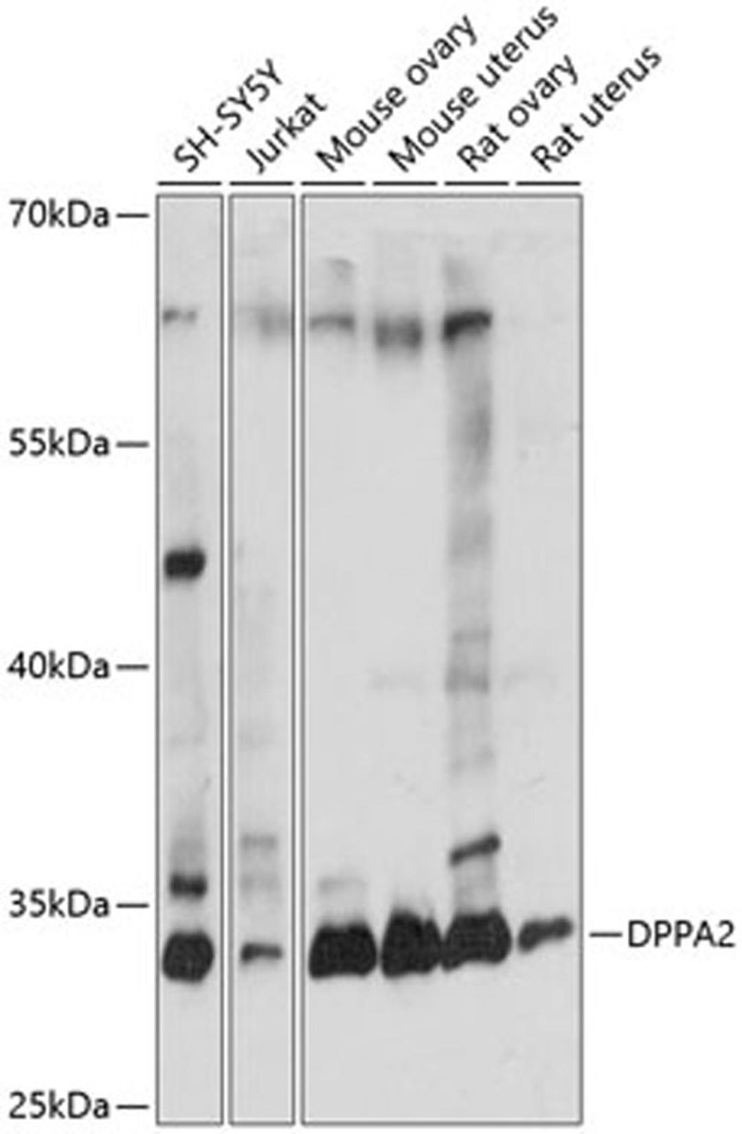 Western blot - DPPA2 antibody (A14966)