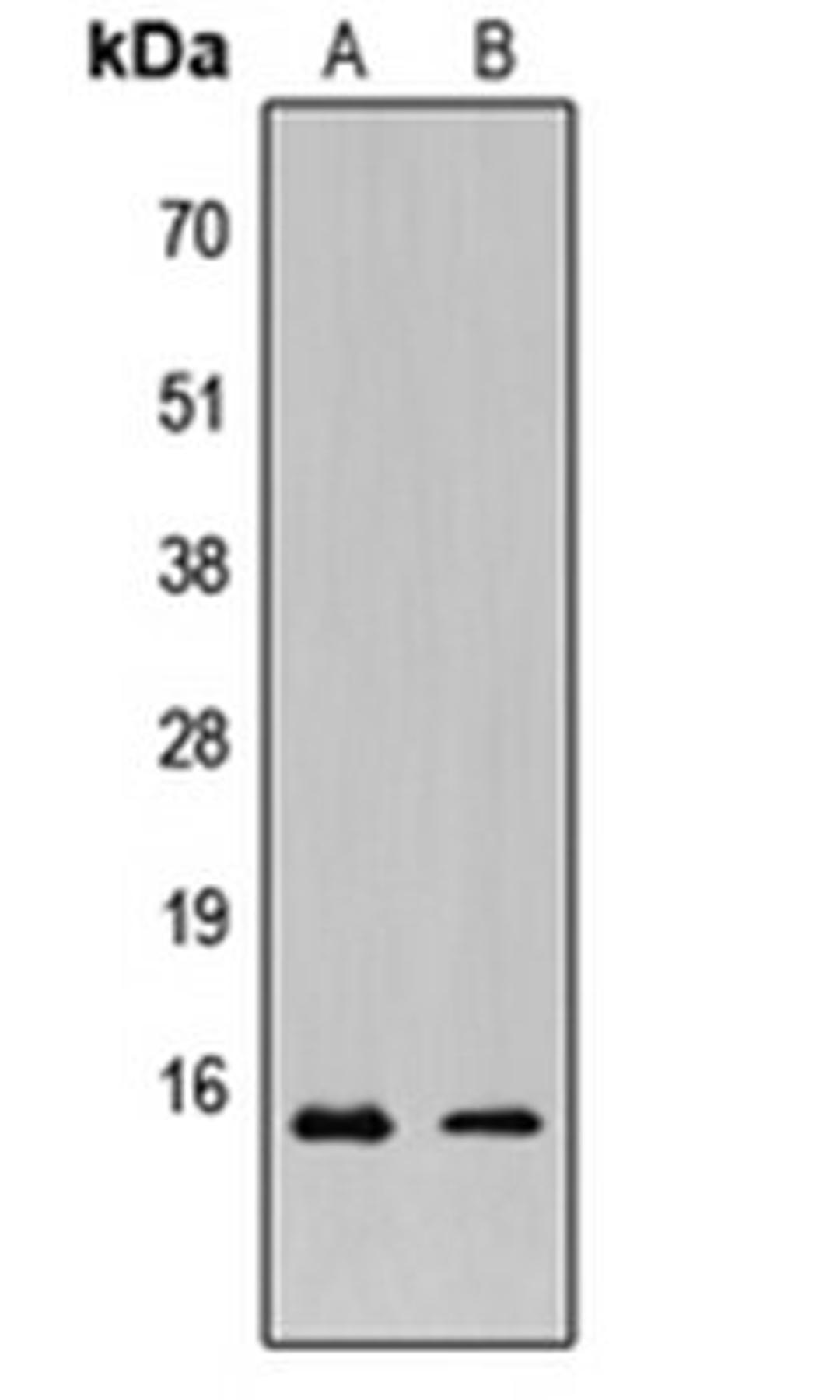 Western blot analysis of HeLa (Lane 1), MCF7 (Lane 2) whole cell lysates using KCNE1L antibody