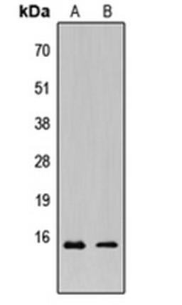 Western blot analysis of HeLa (Lane 1), MCF7 (Lane 2) whole cell lysates using KCNE1L antibody