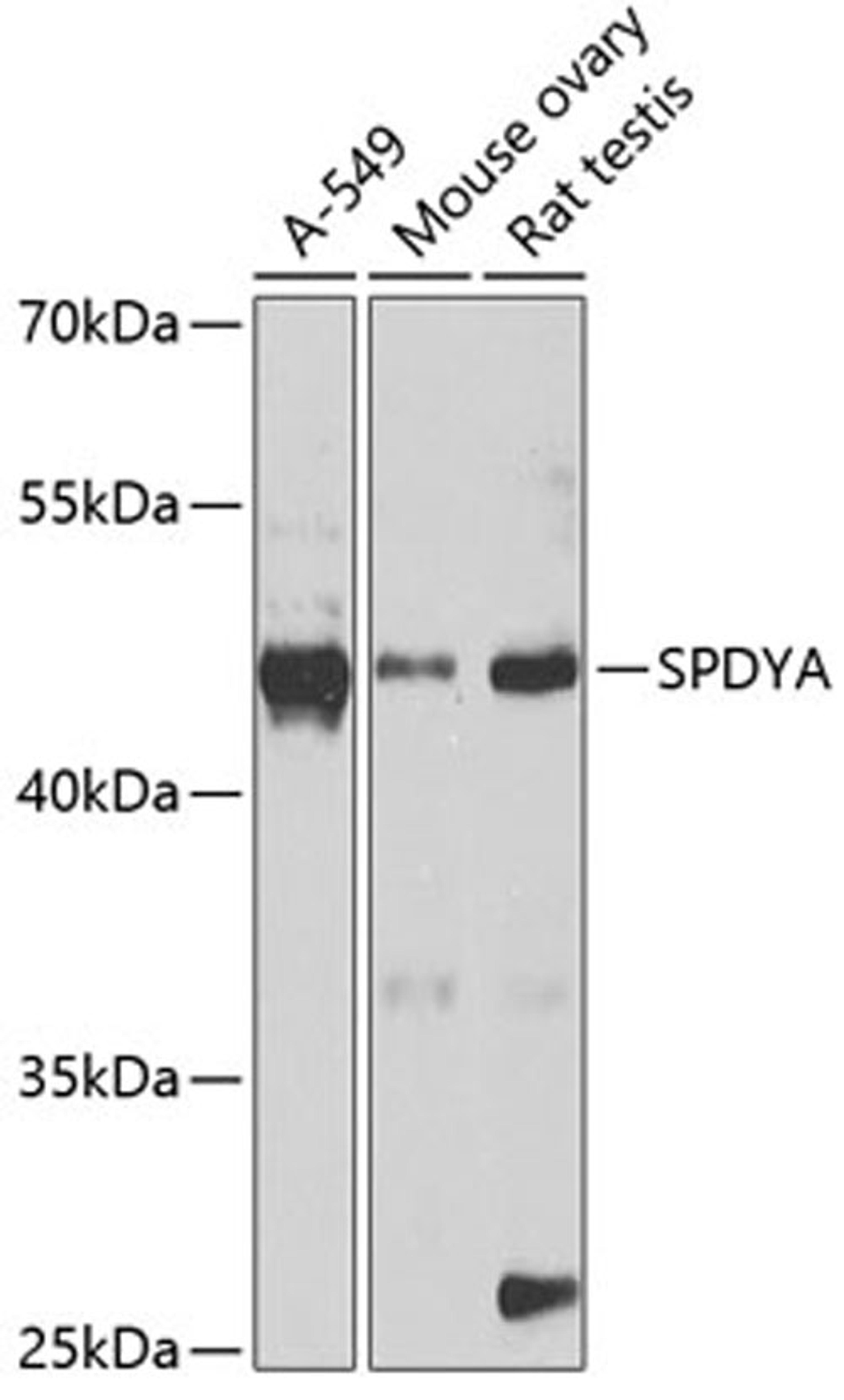 Western blot - SPDYA antibody (A2153)