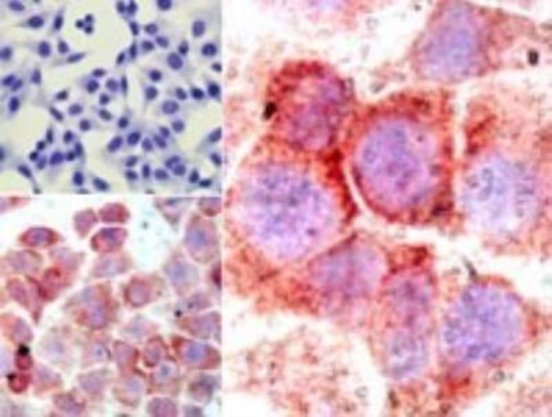 Immunohistochemistry-Paraffin: NFkB p65 NLS Antibody [NBP2-24541] - NFkB p65 NLS Antibody analysis of p65 NLS in formalin-fixed, paraffin-embedded human HeLa cells (top left) and LPS-stimulated HeLa cells (bottom left, right) using p65 NLS antibody at 5 ug/ml.